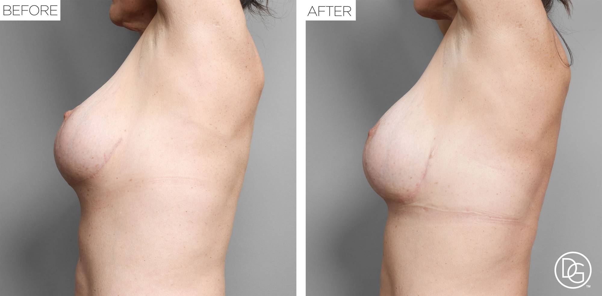 Before & After Image
