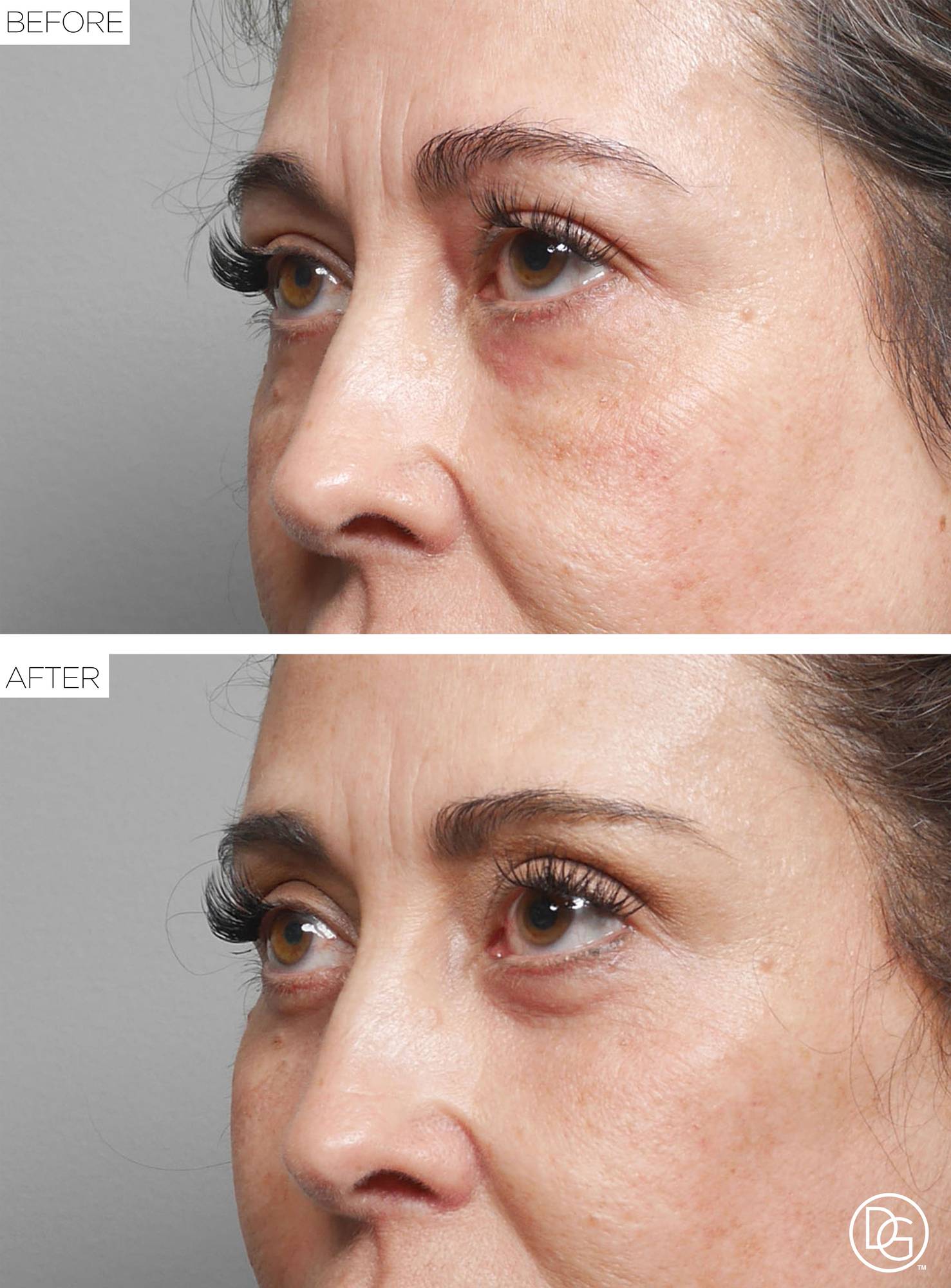 Before & After Image