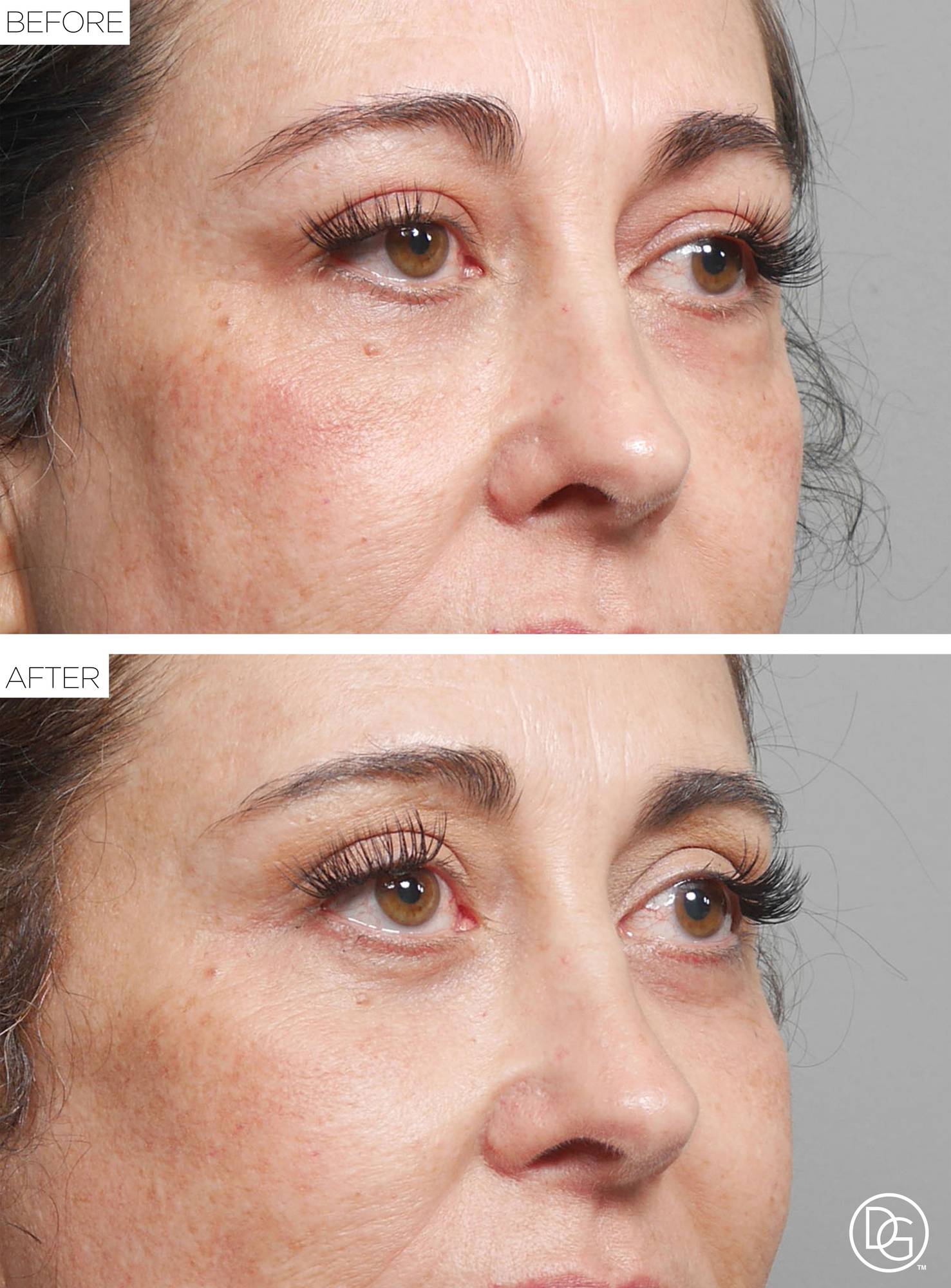 Before & After Image