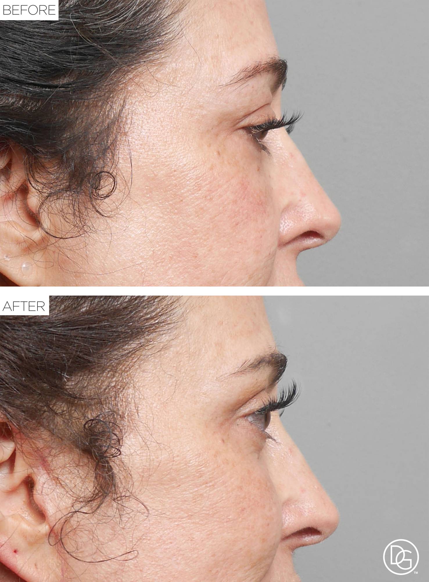 Before & After Image