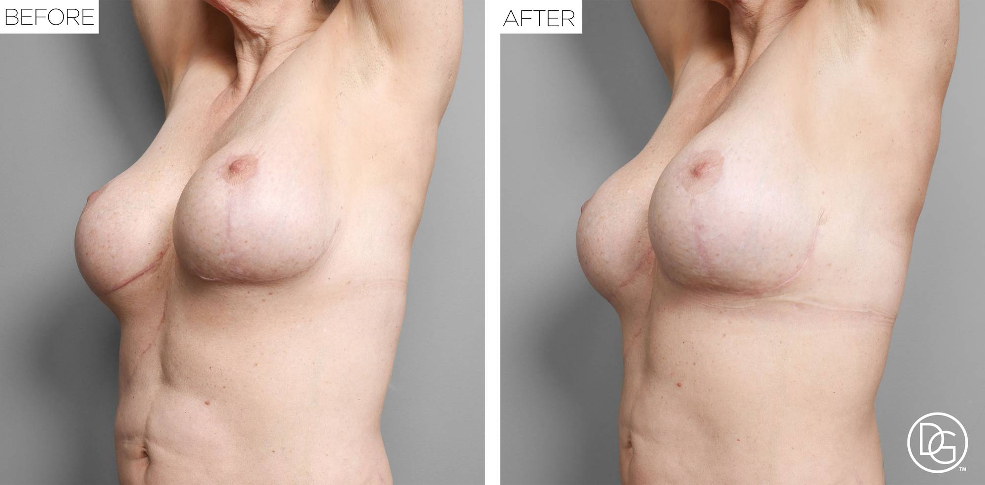 Before & After Image