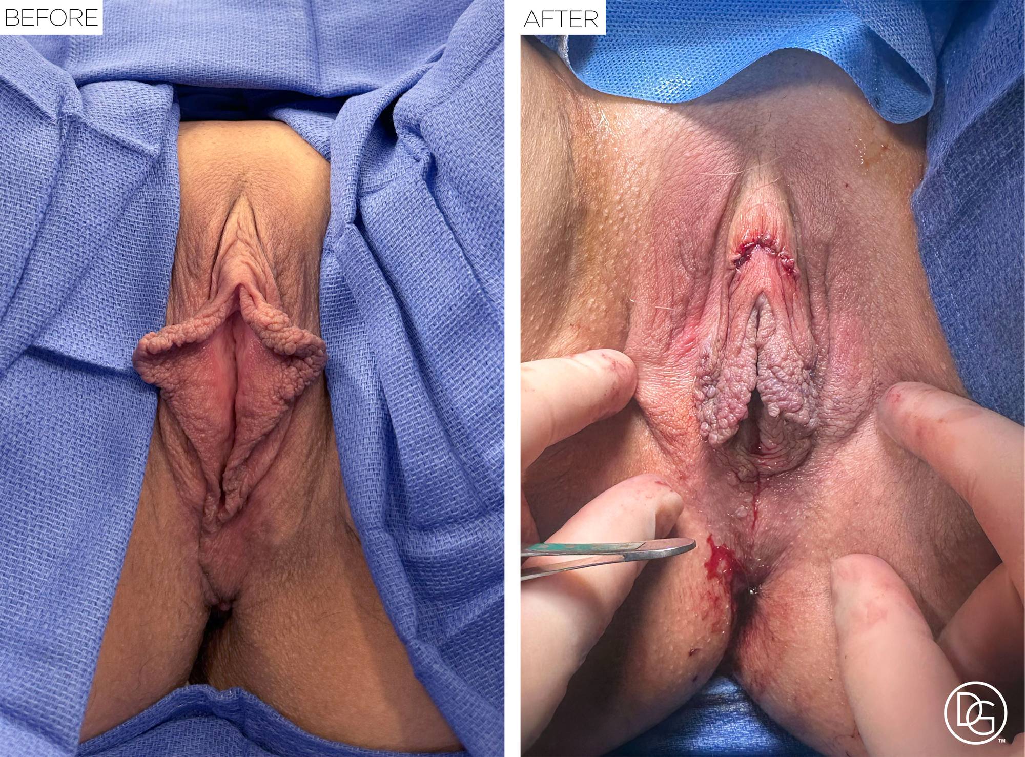 Before & After Image