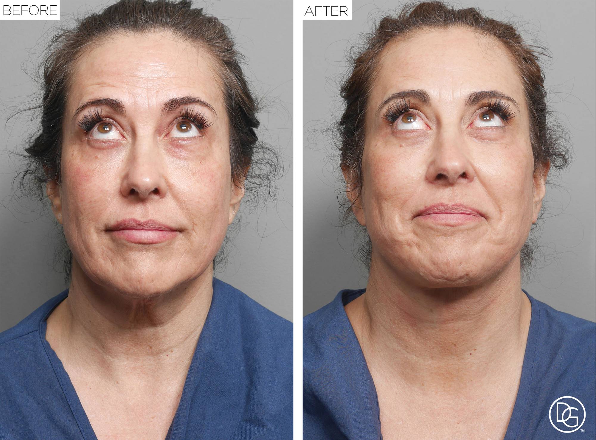Before & After Image