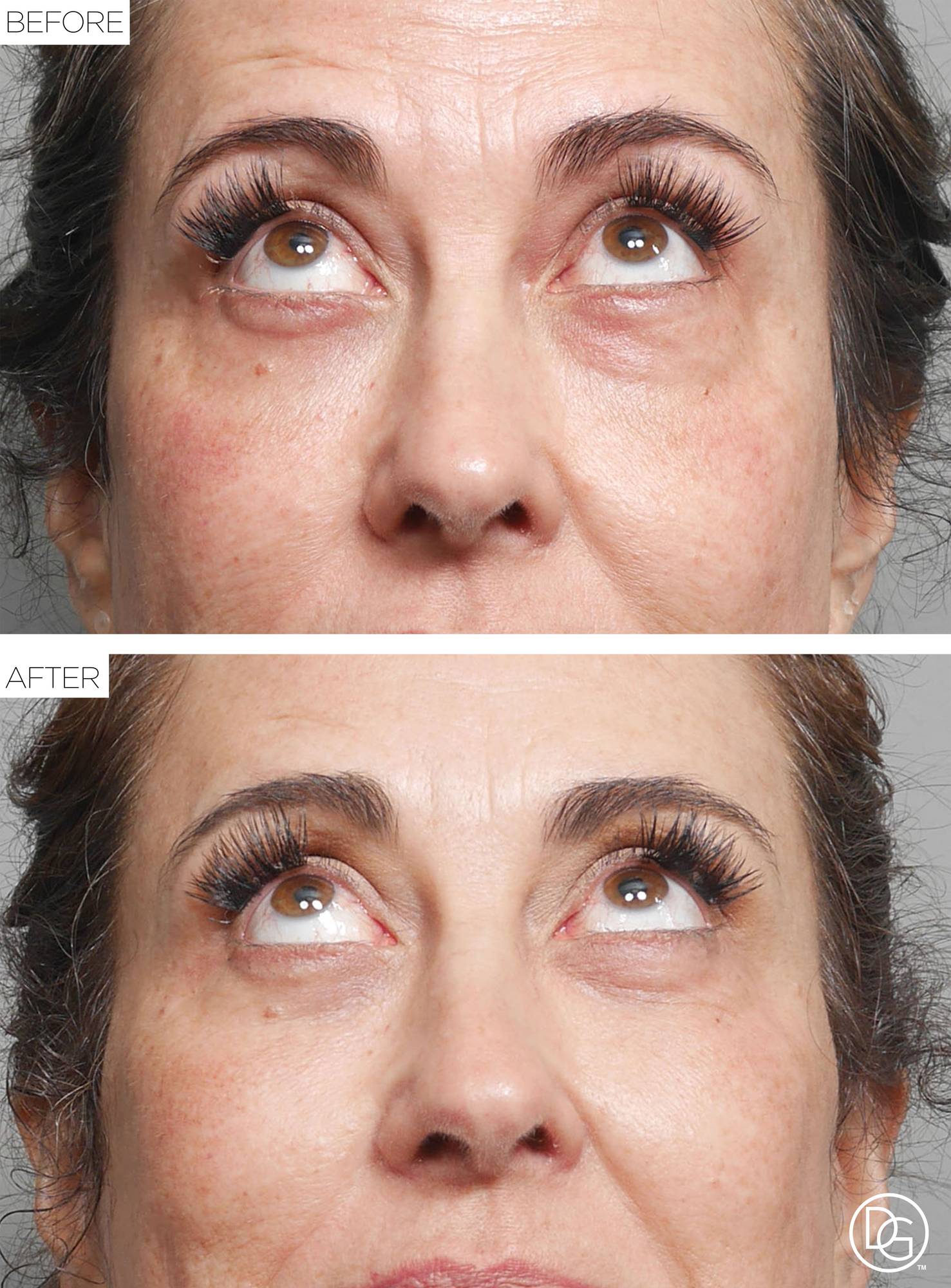 Before & After Image
