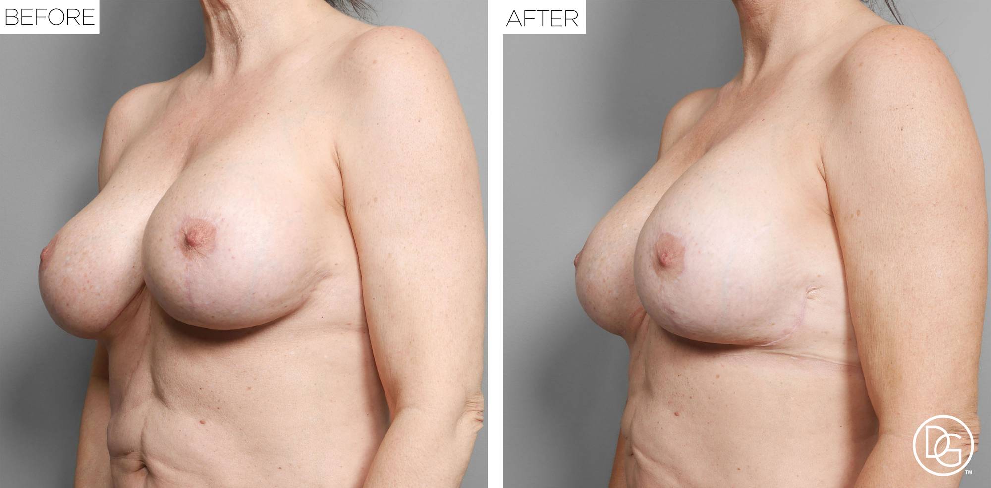Before & After Image