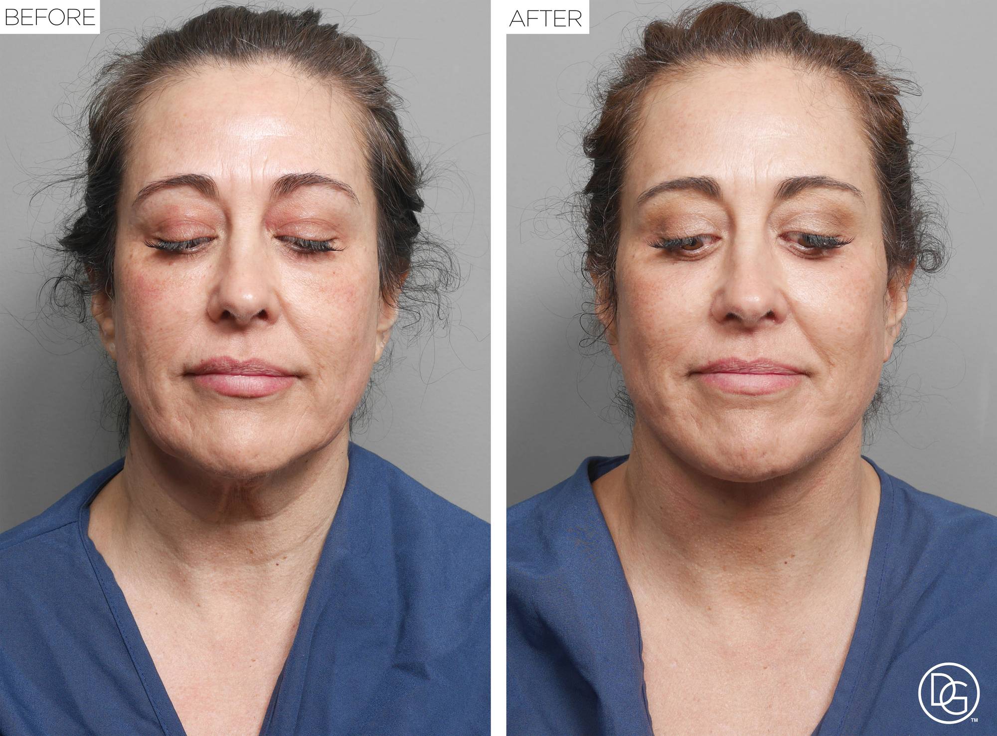 Before & After Image