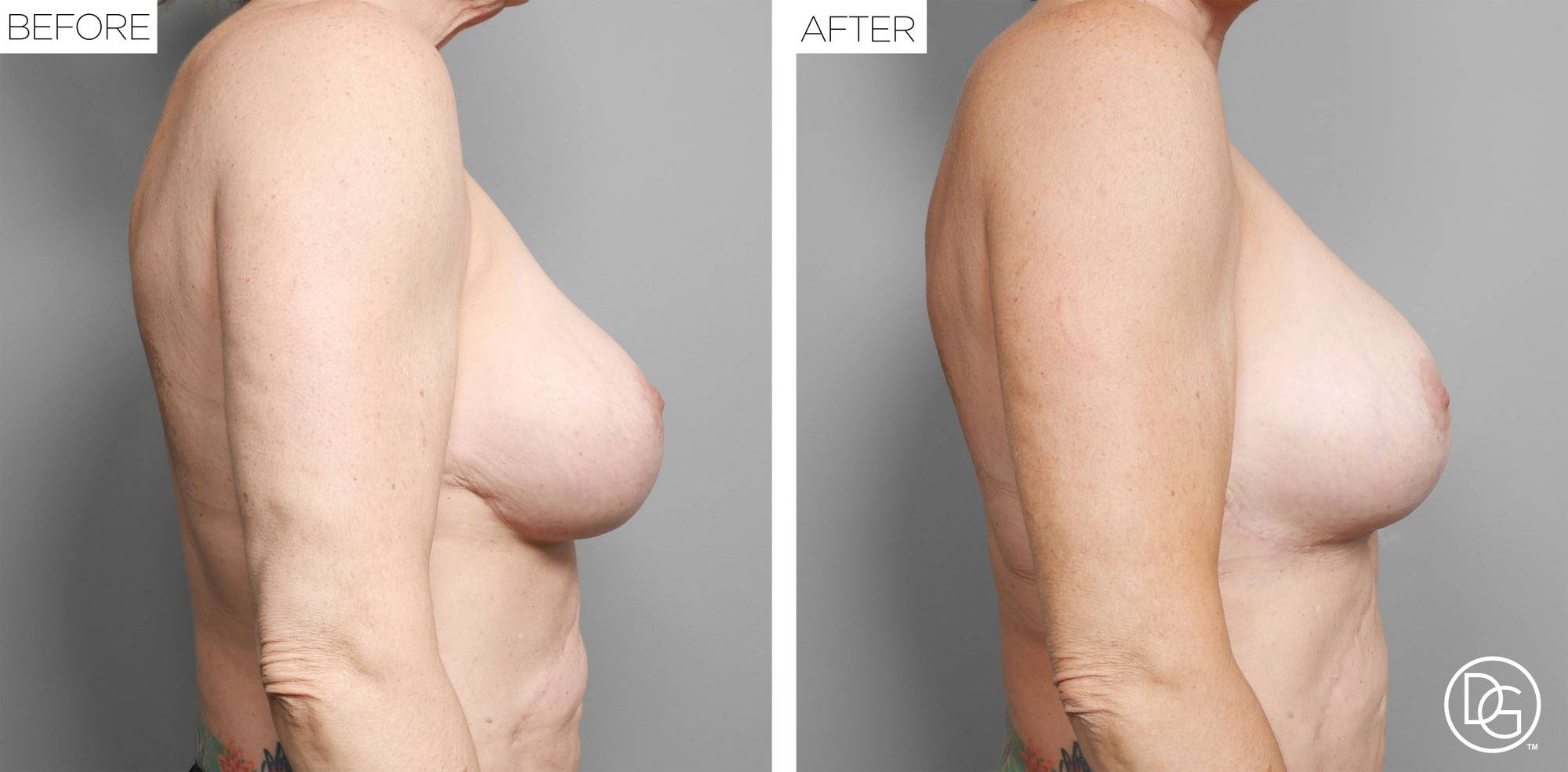 Before & After Image
