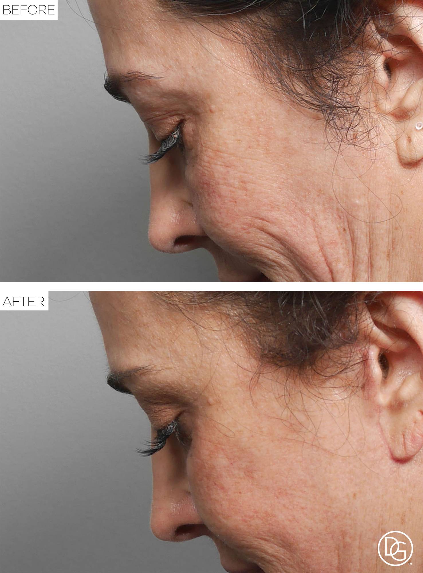 Before & After Image