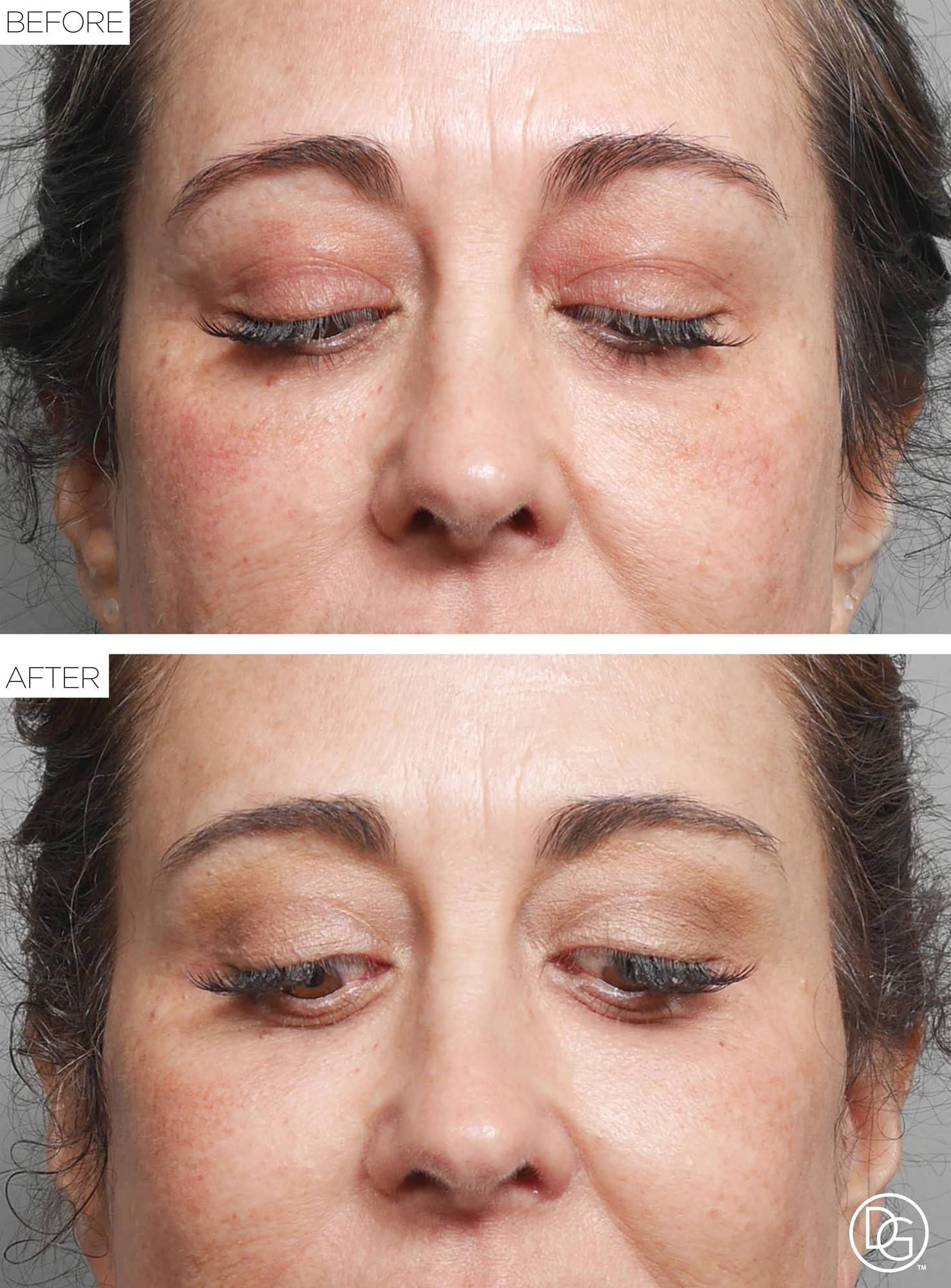 Before & After Image