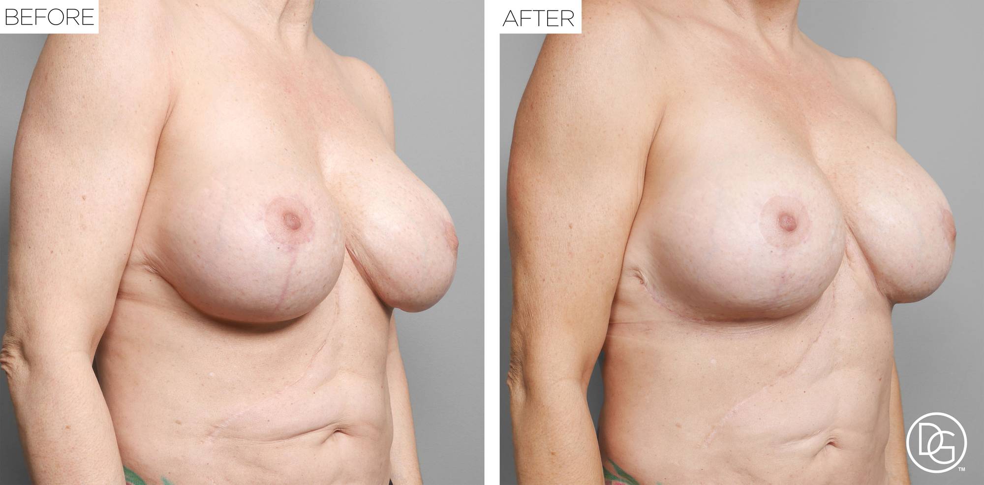 Before & After Image