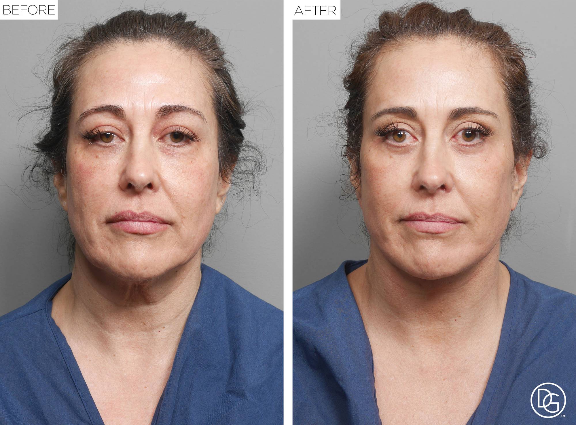 Before & After Image