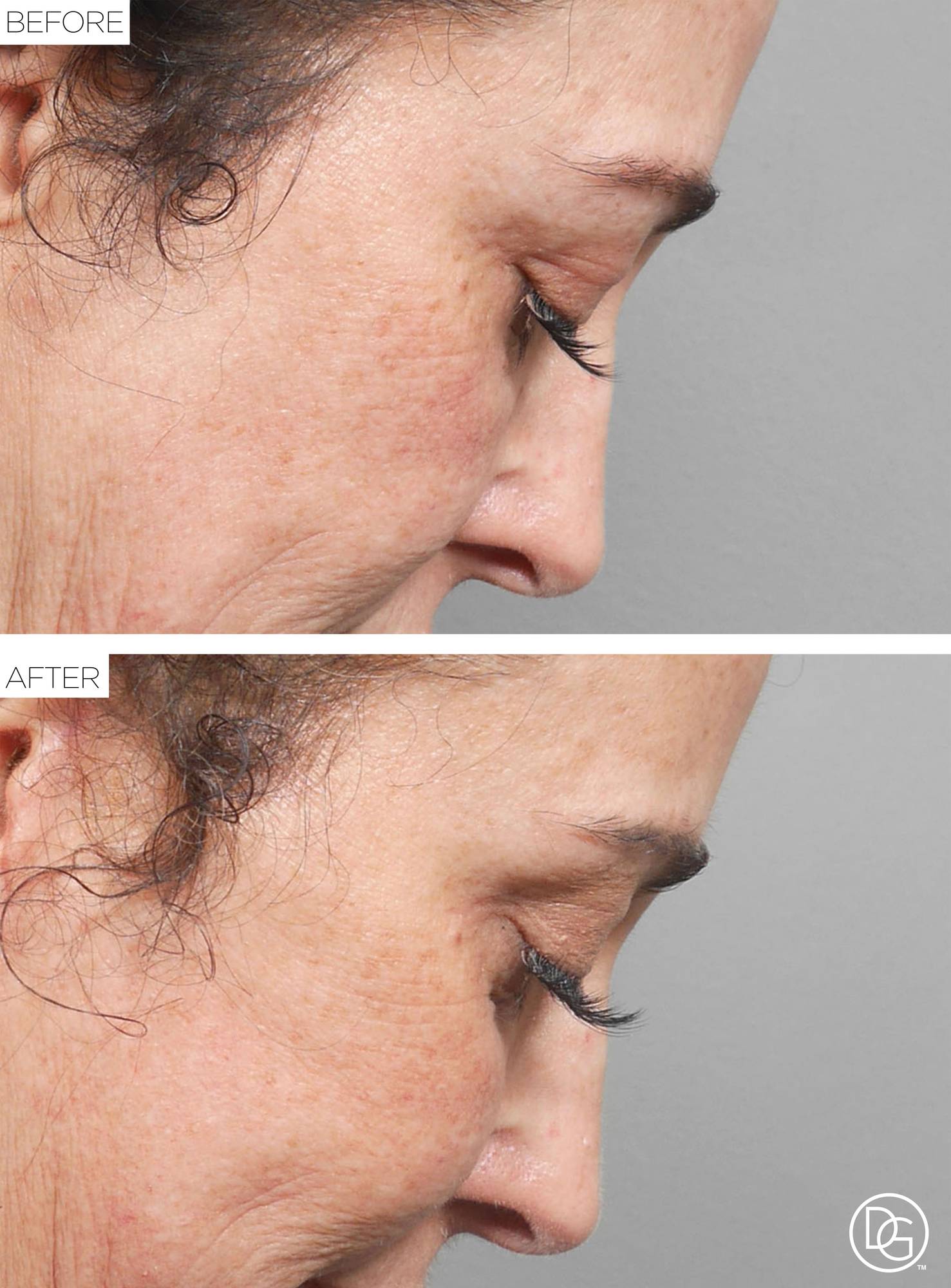 Before & After Image