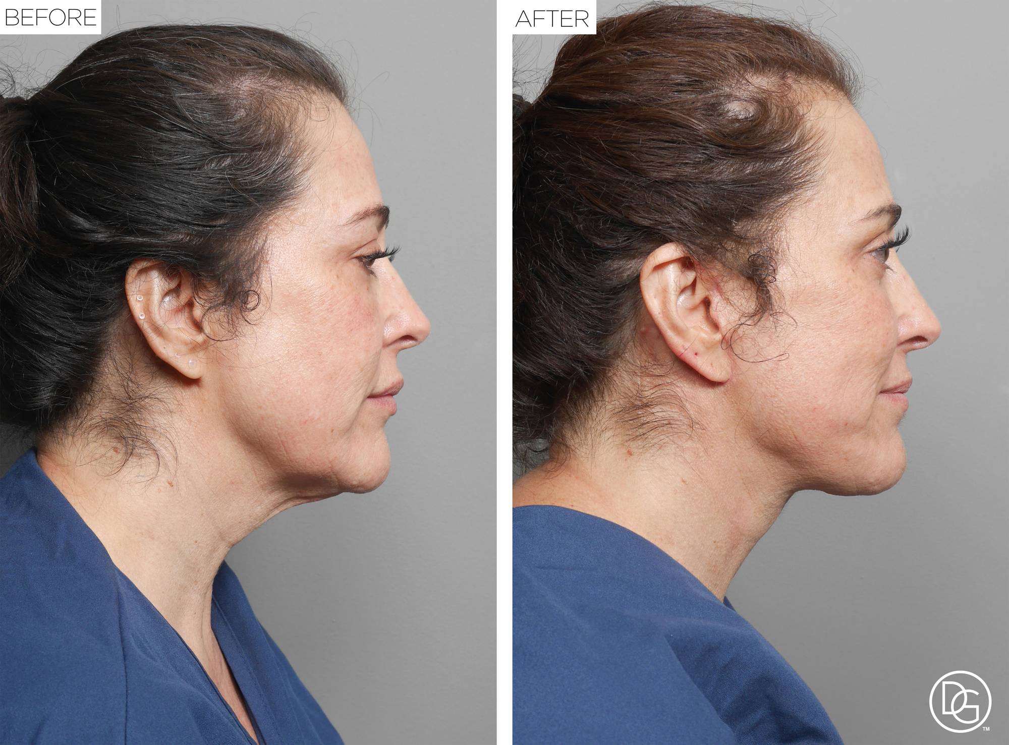 Before & After Image