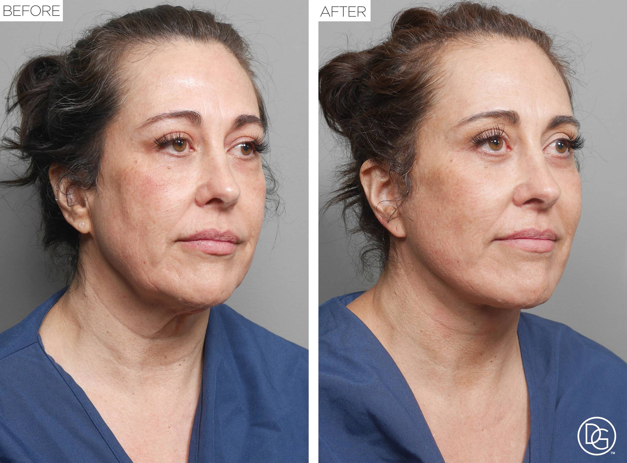 Before & After Image