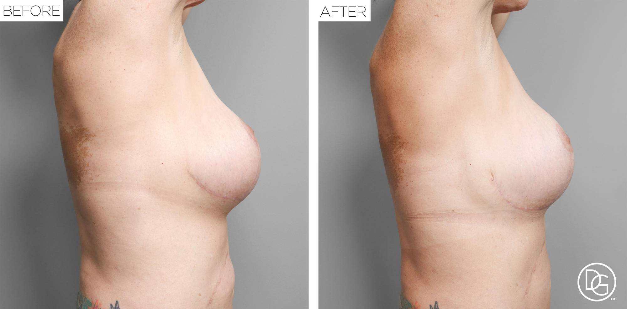 Before & After Image
