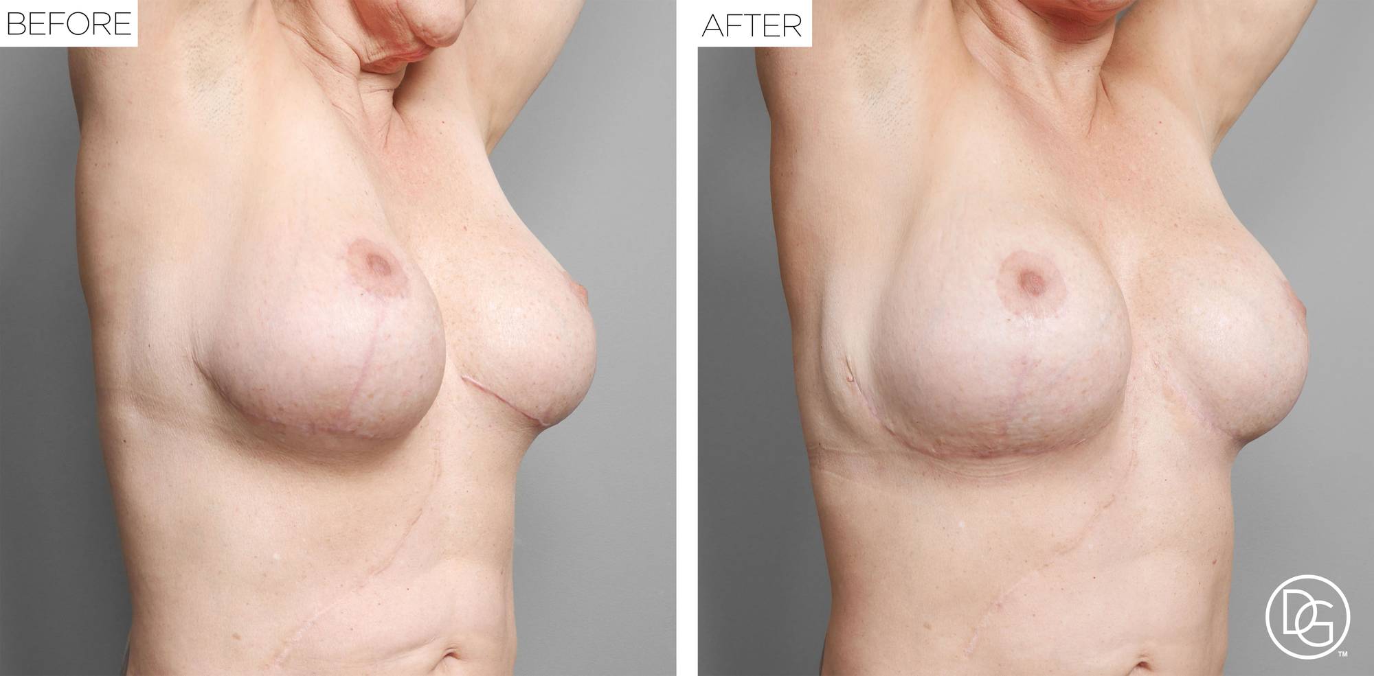 Before & After Image