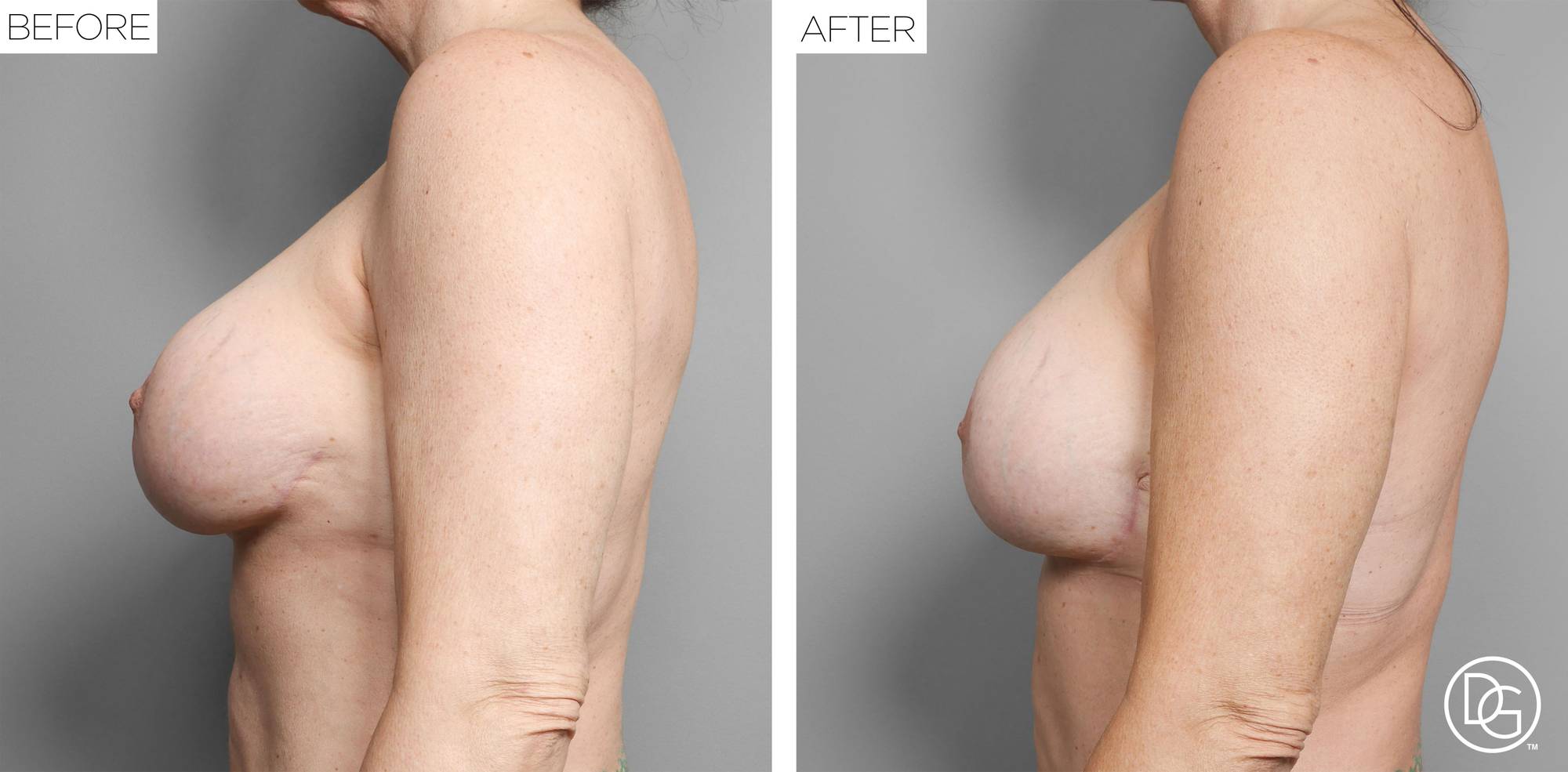 Before & After Image