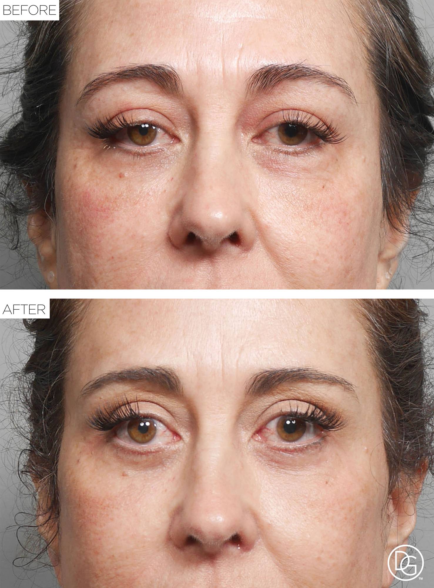 Before & After Image