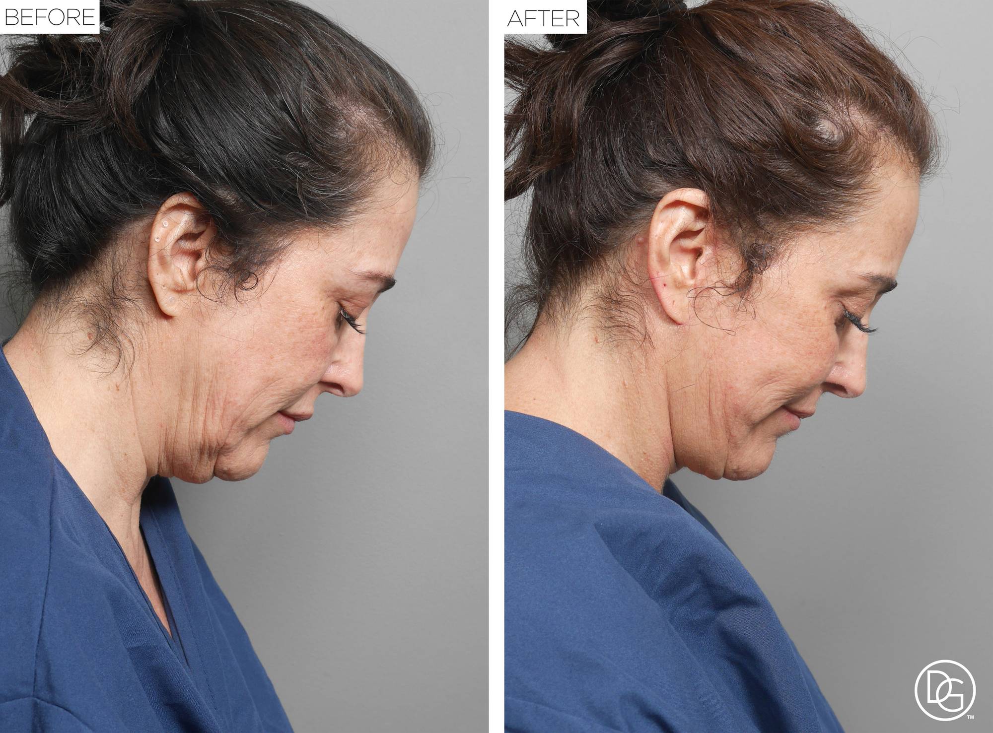 Before & After Image