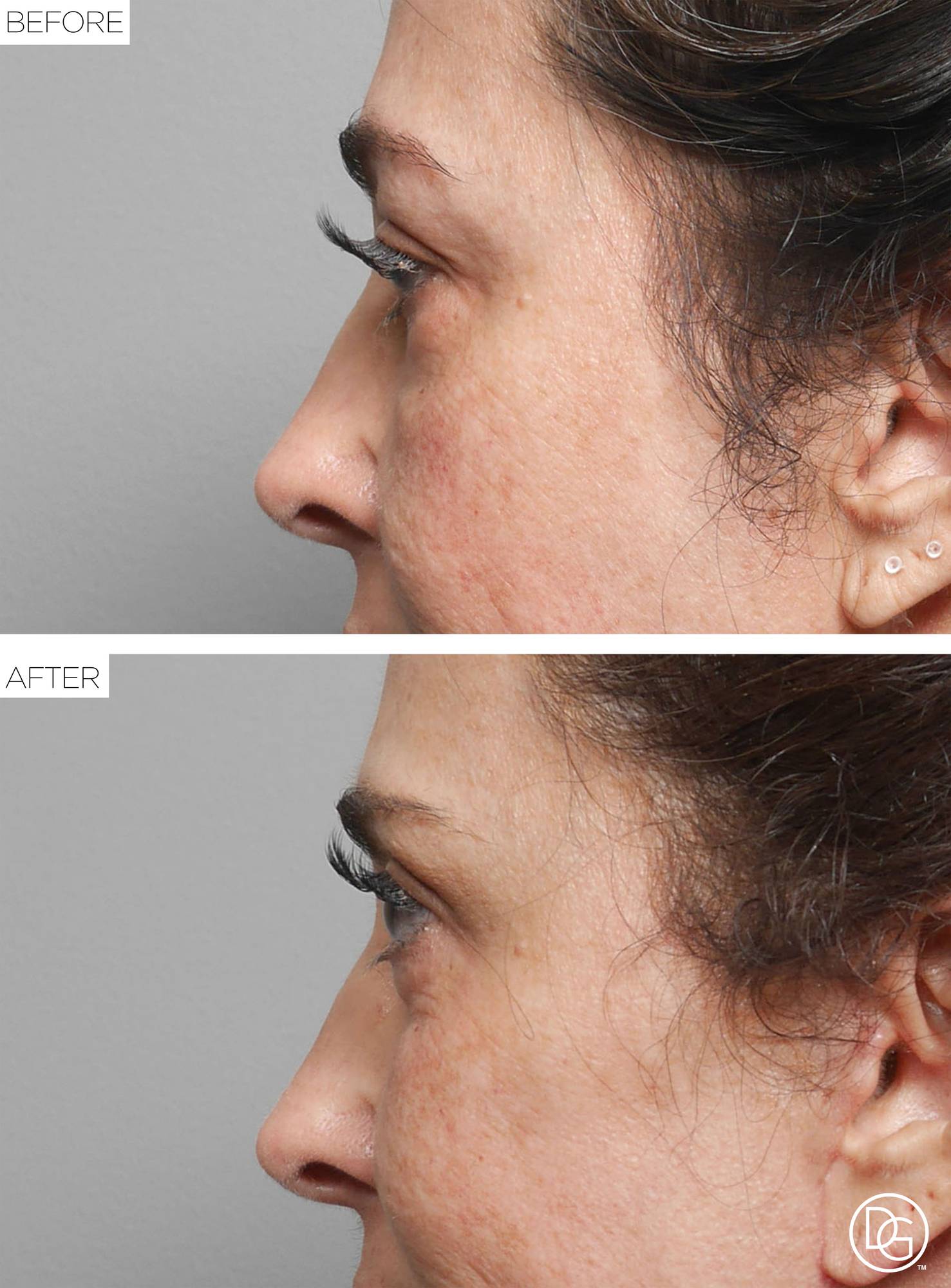 Before & After Image