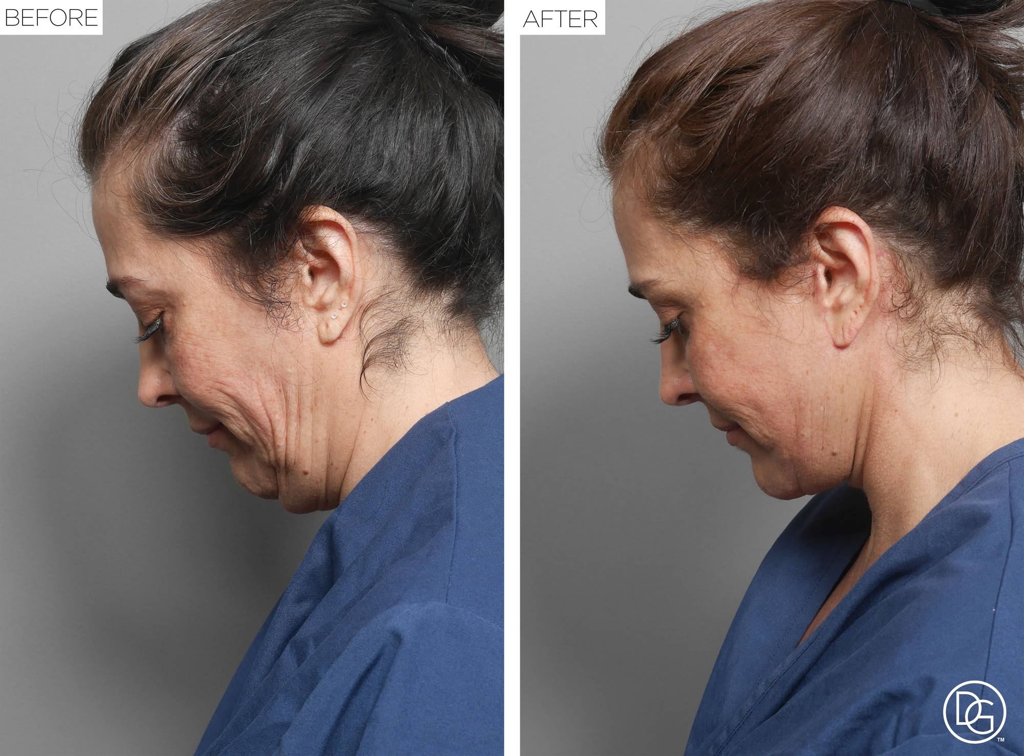 Before & After Image