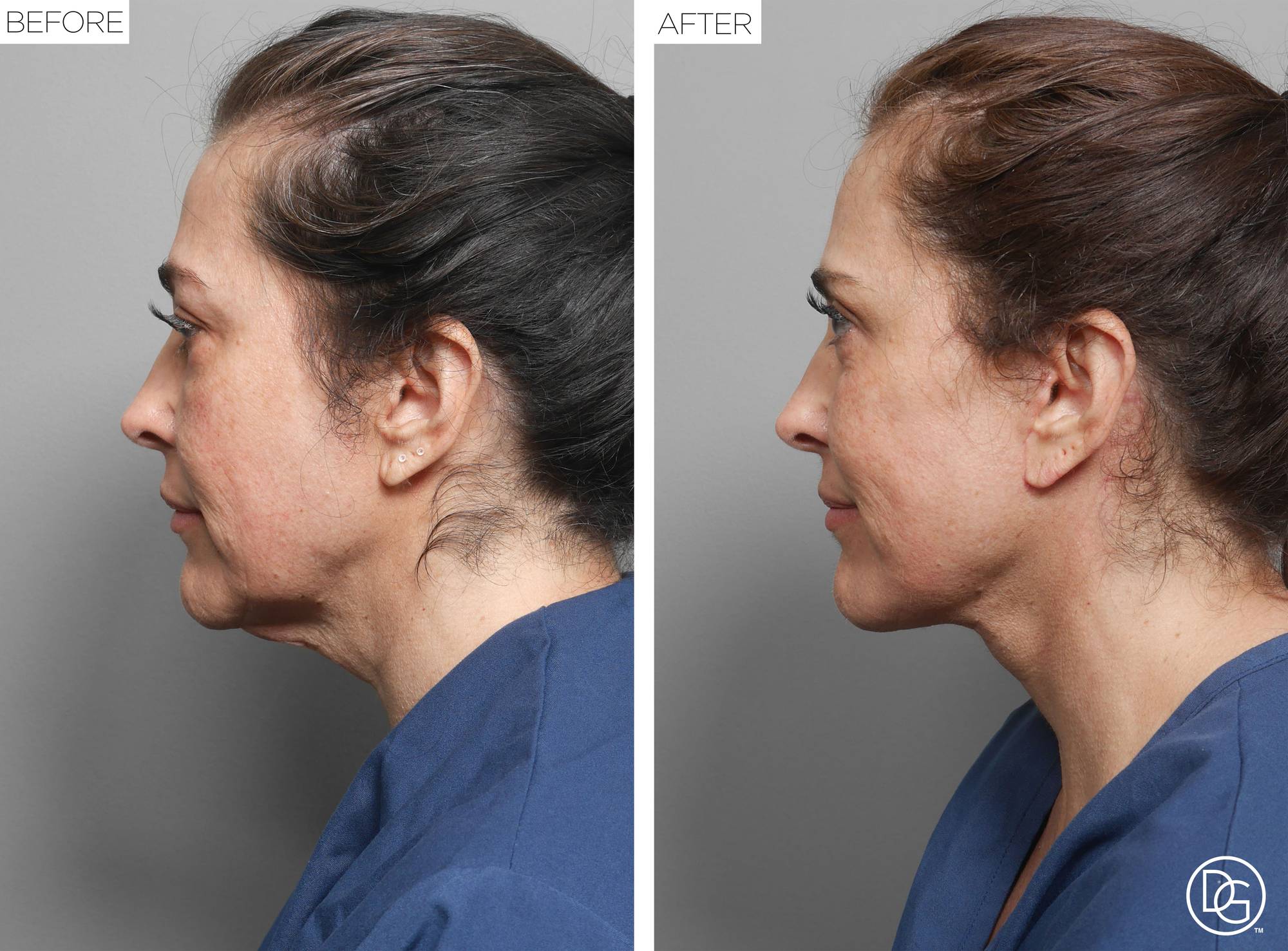 Before & After Image