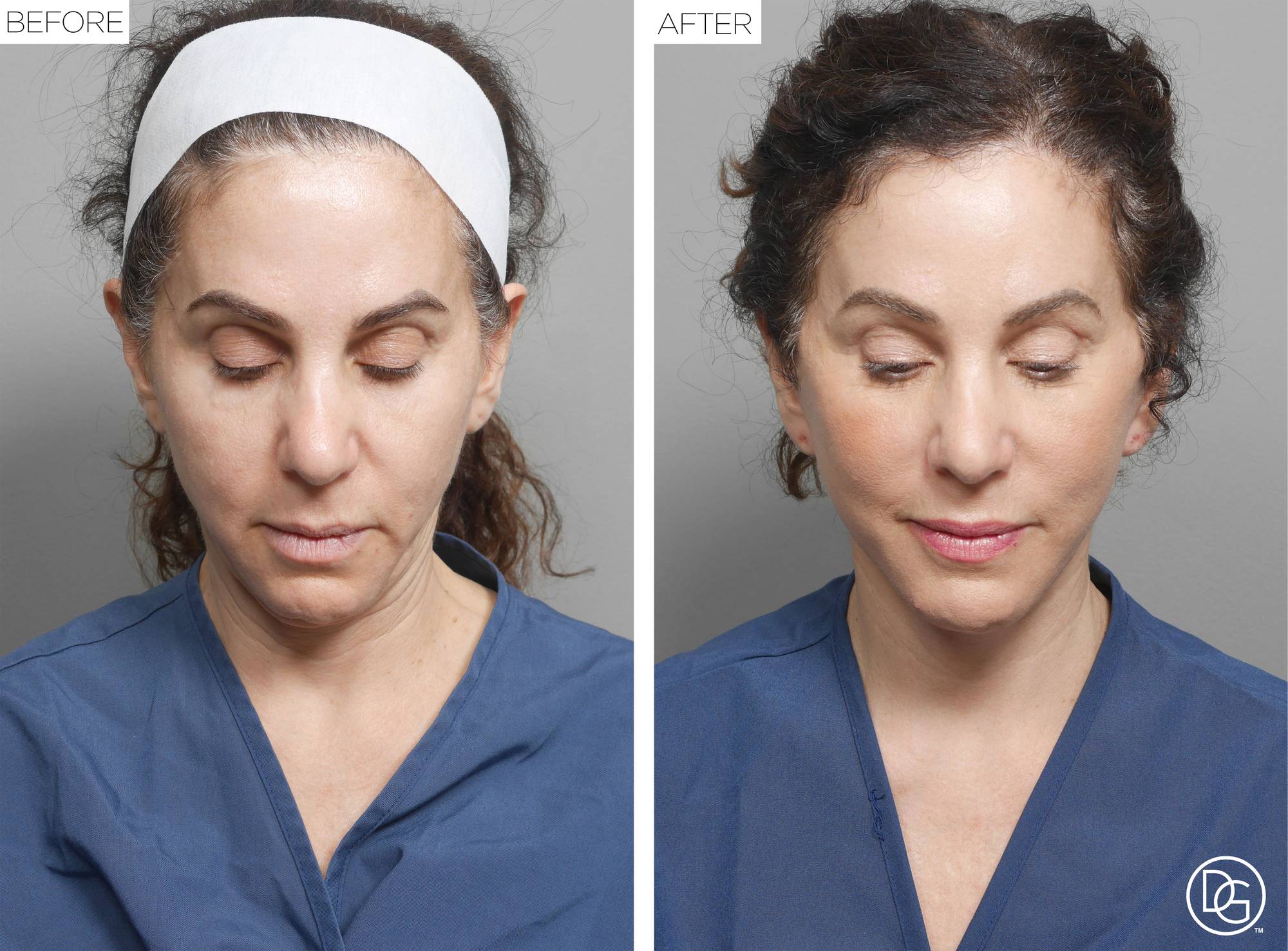 Before & After Image