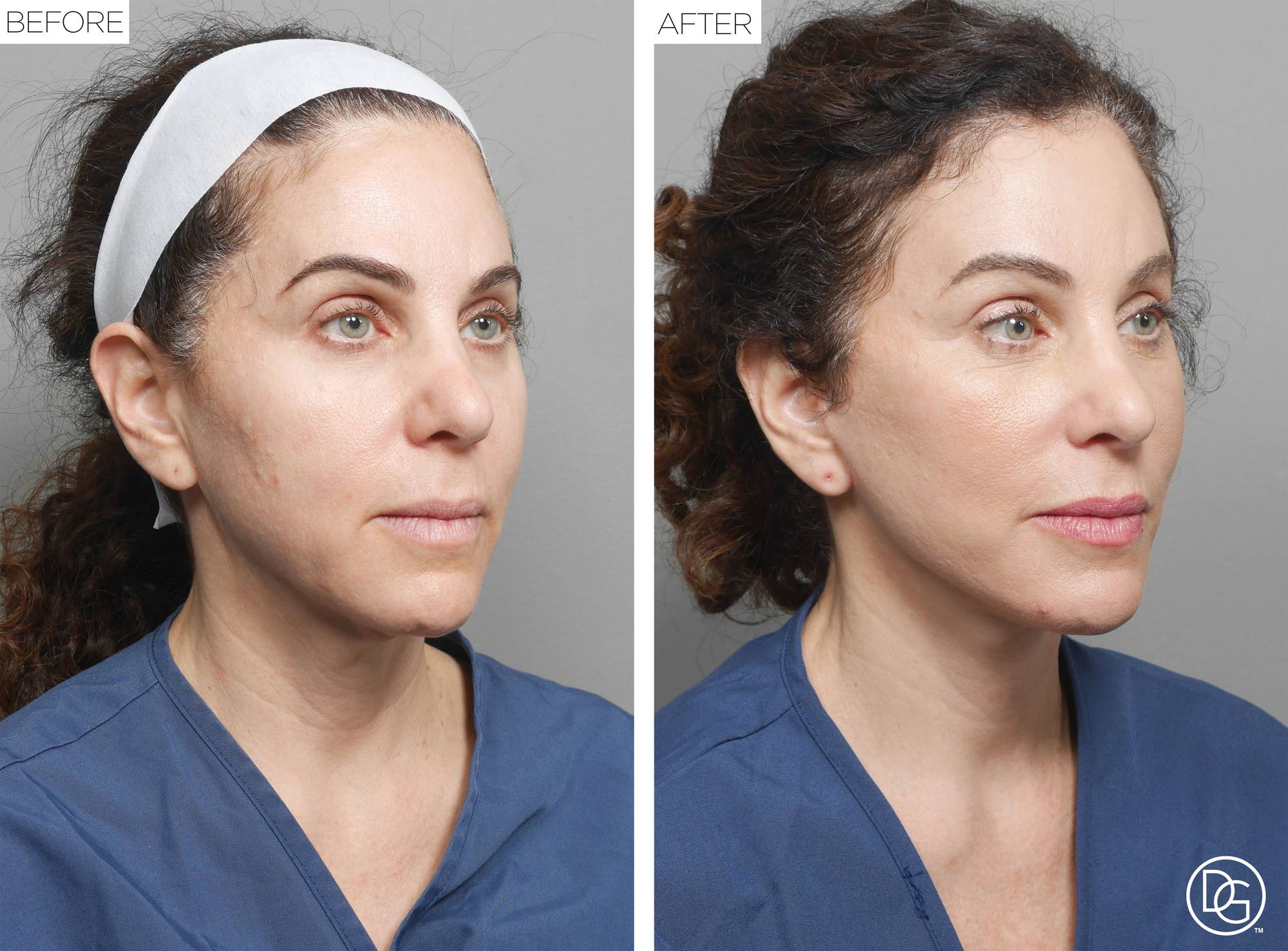 Before & After Image