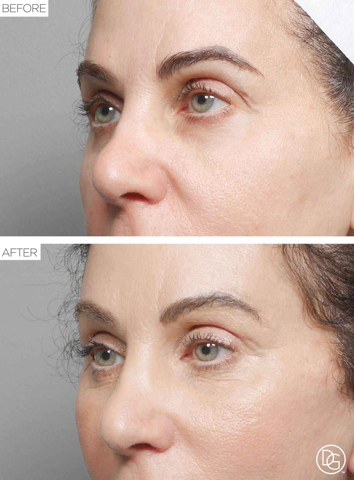 Before & After Image
