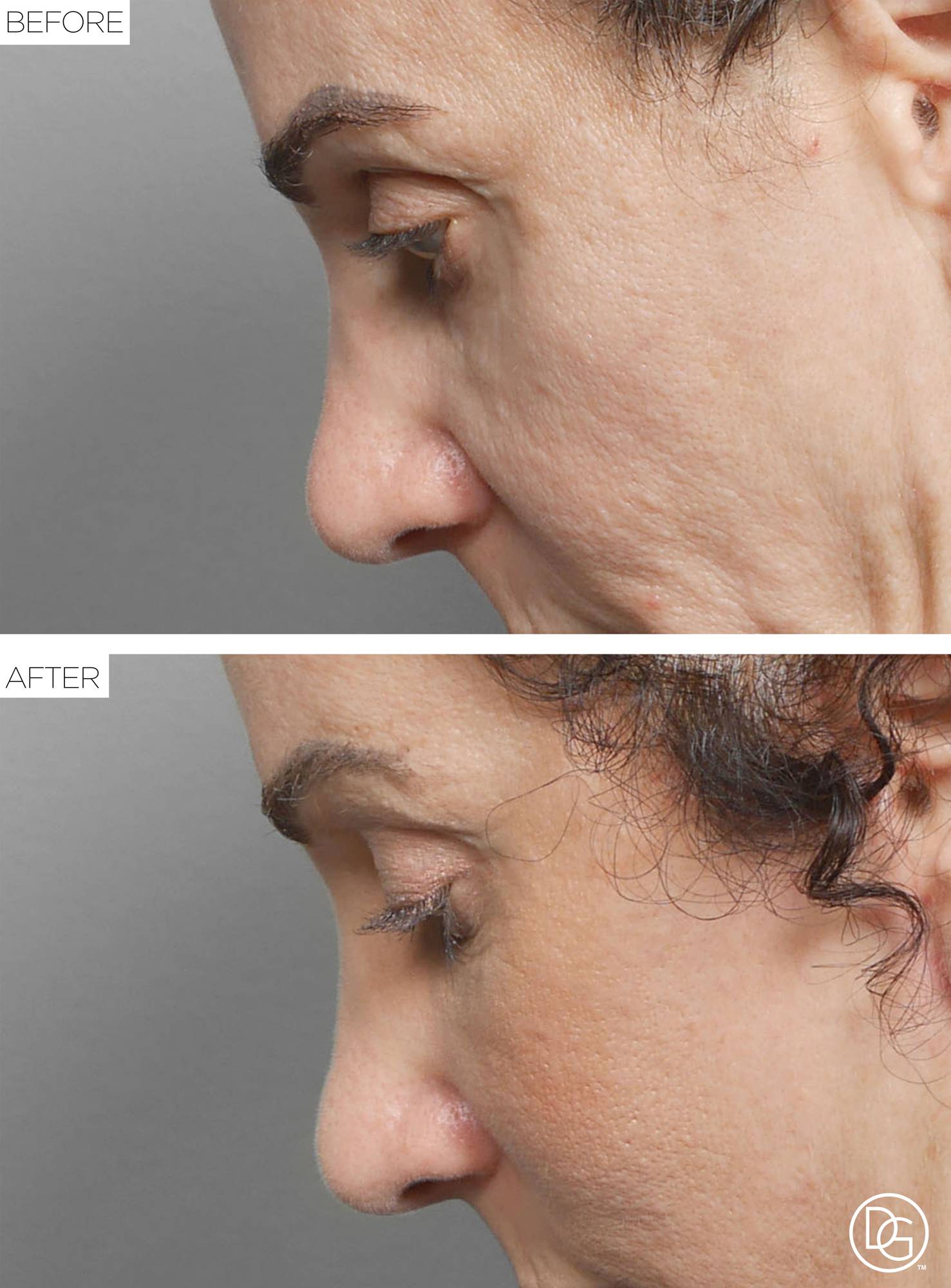 Before & After Image