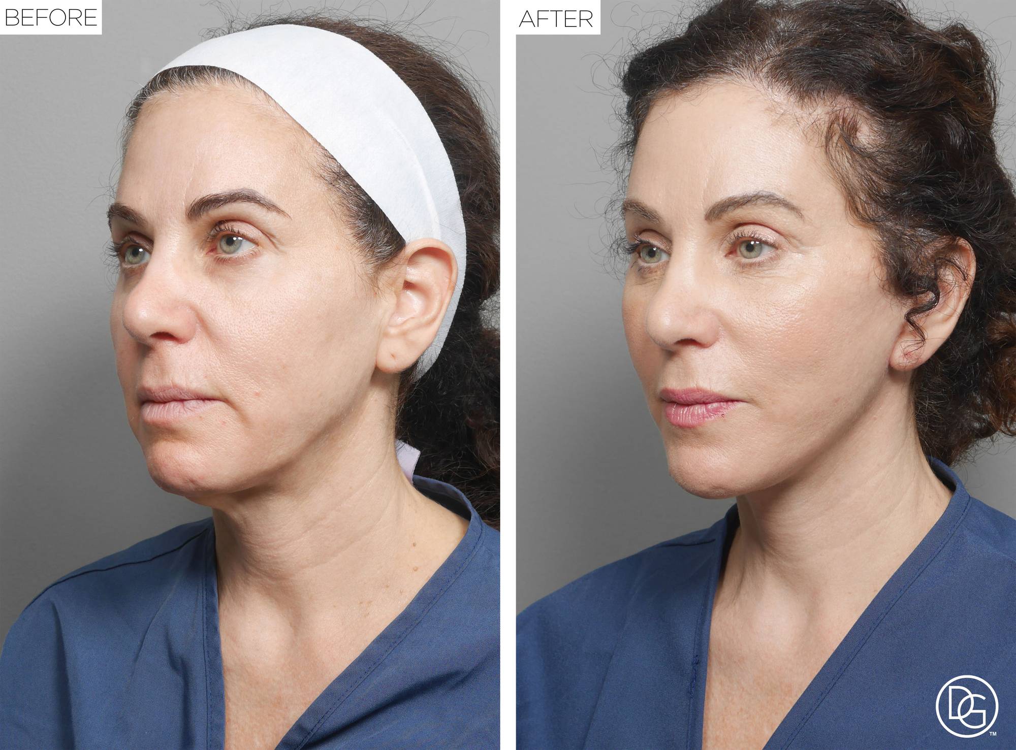 Before & After Image