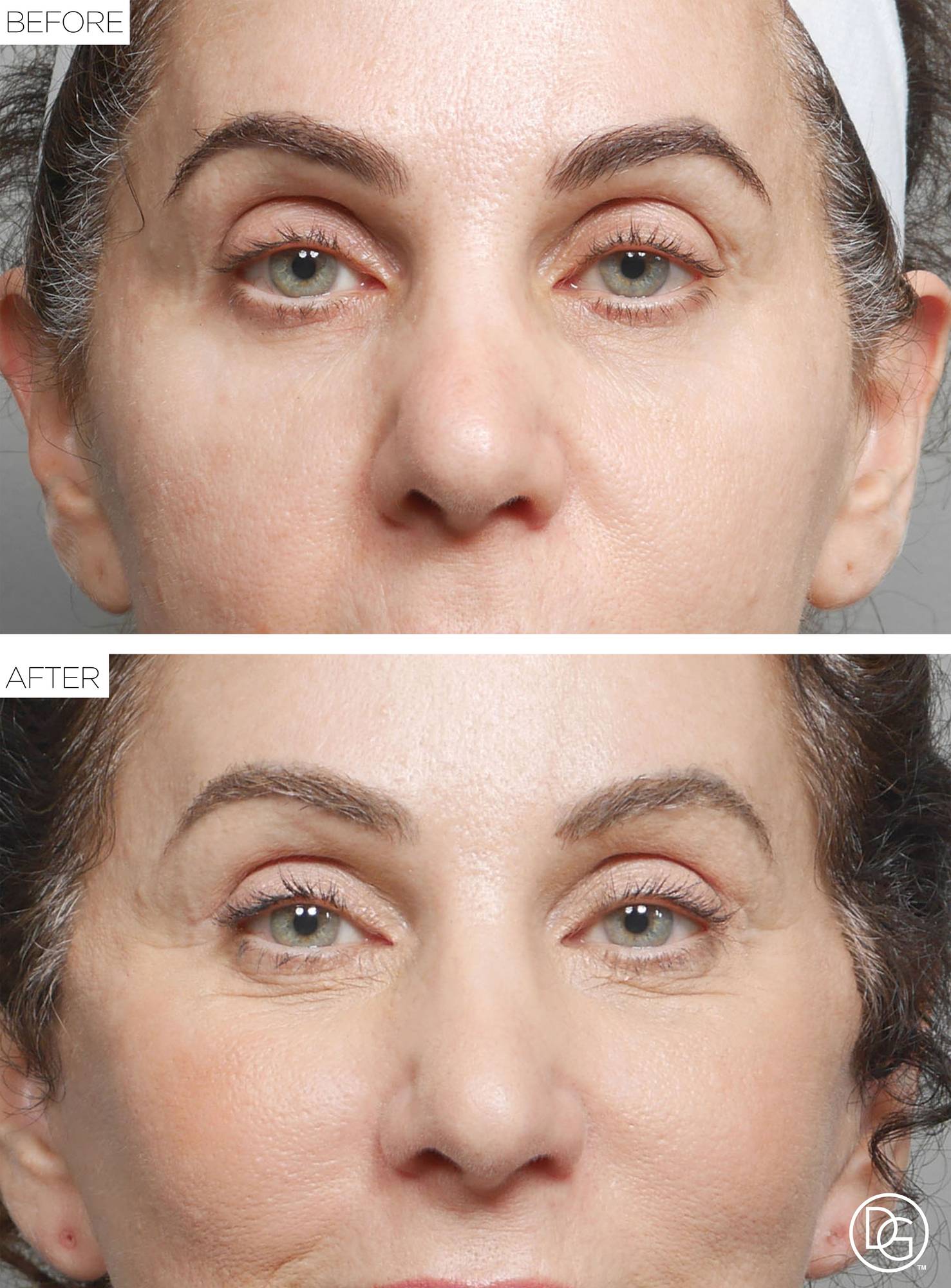 Before & After Image