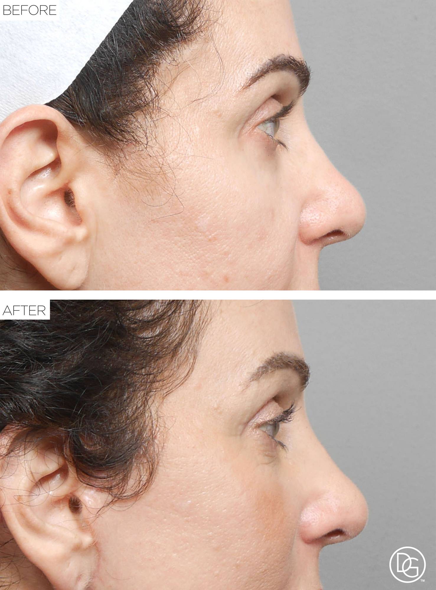 Before & After Image