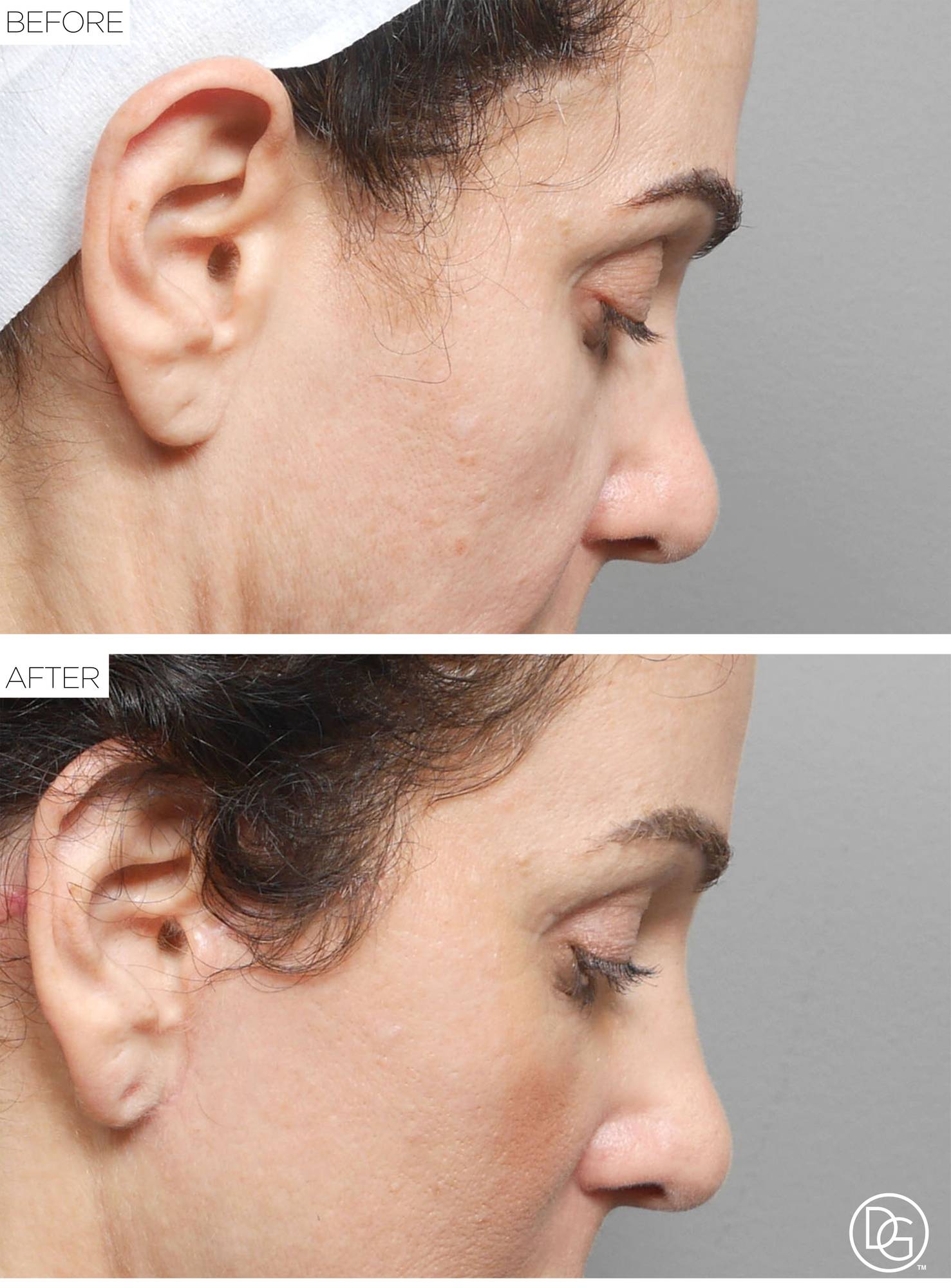 Before & After Image