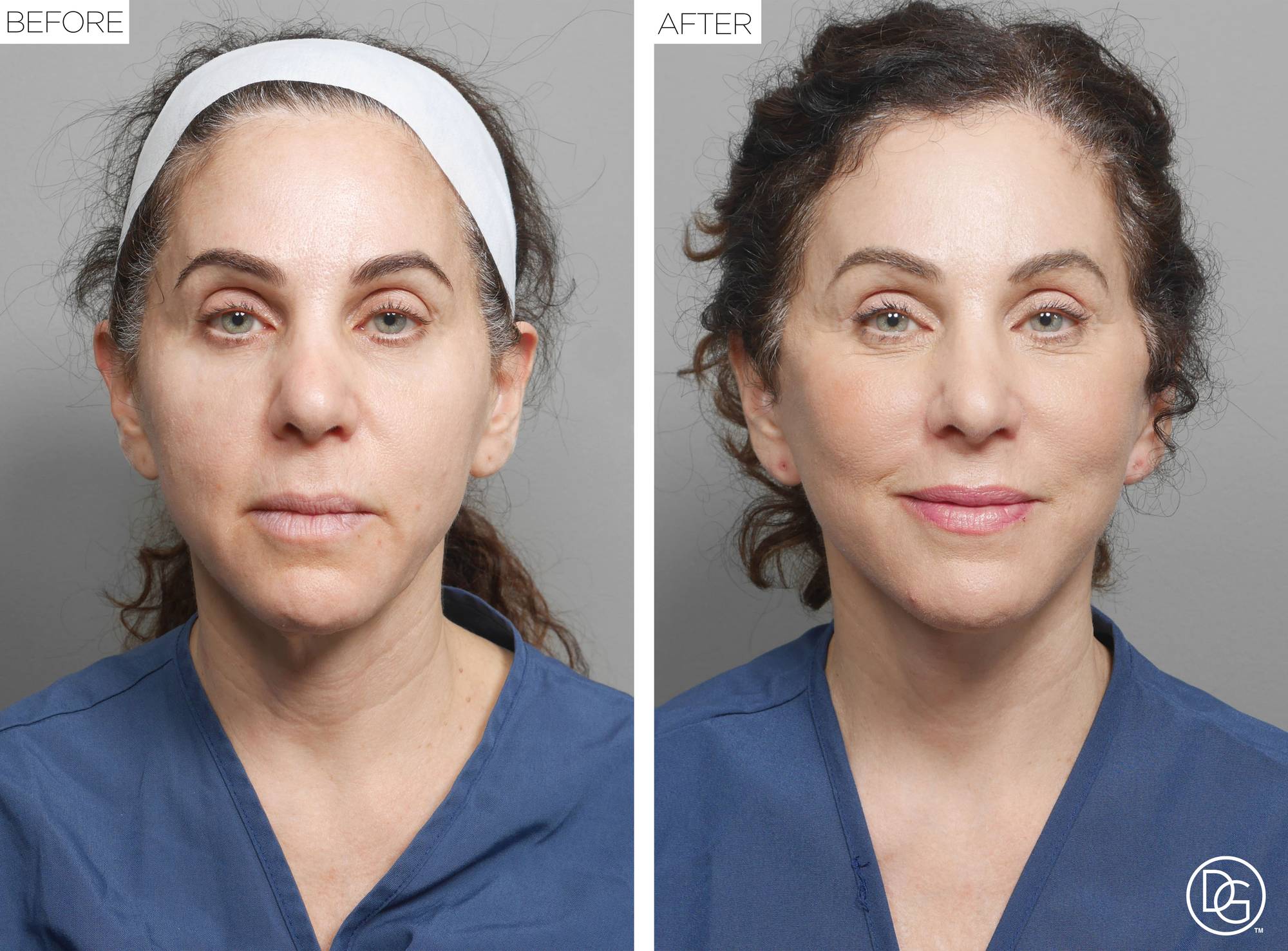 Before & After Image