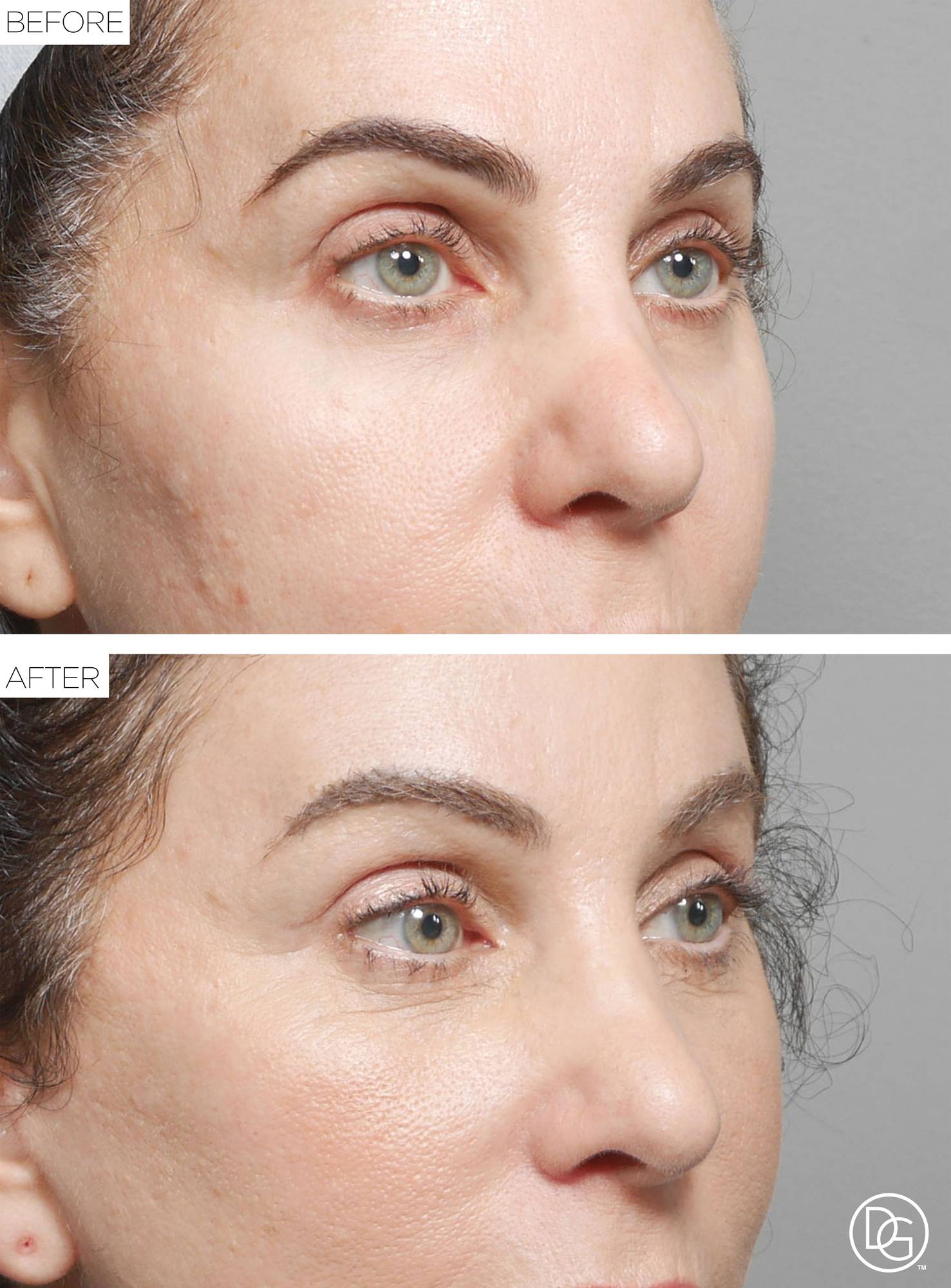 Before & After Image