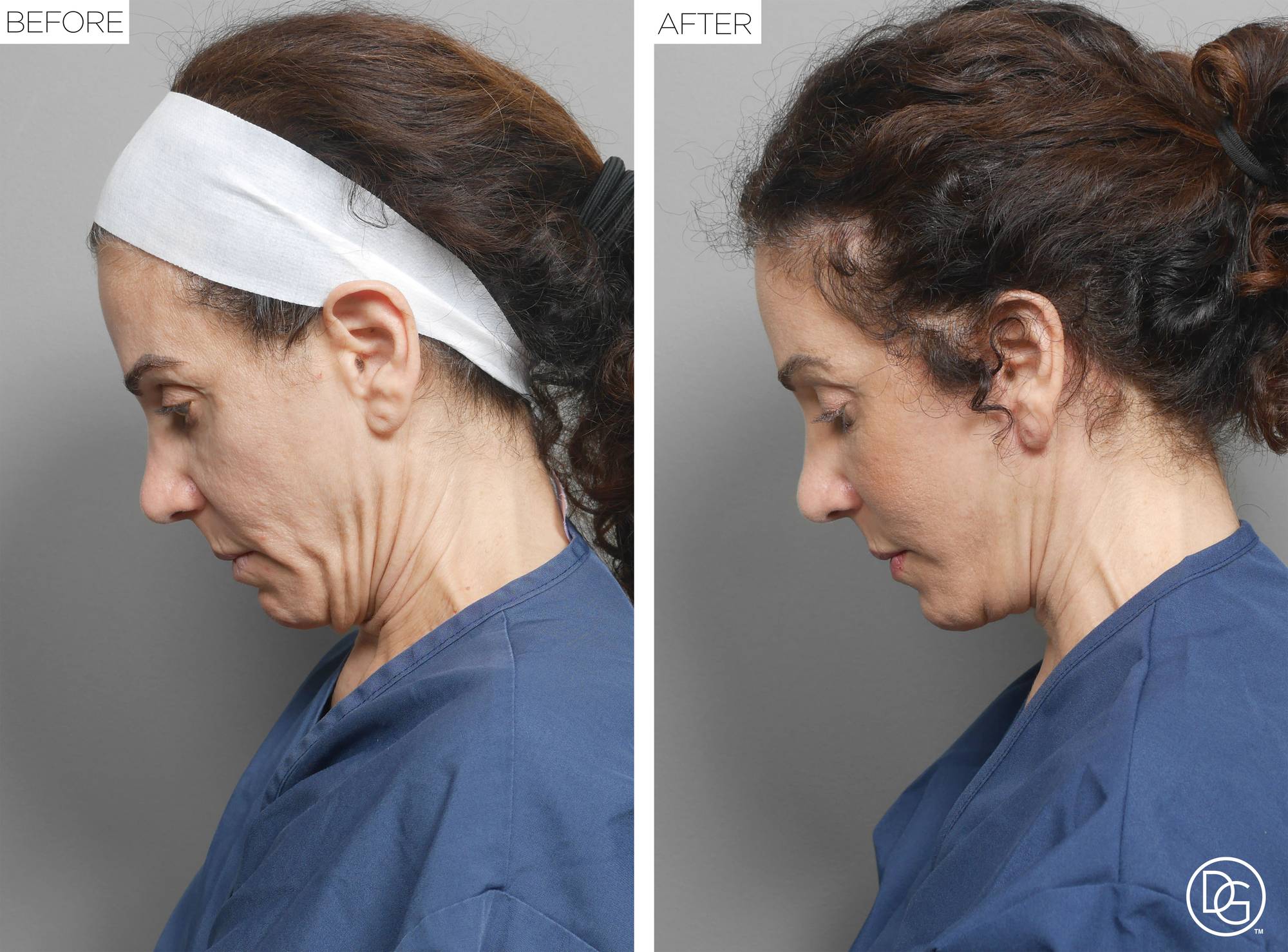 Before & After Image