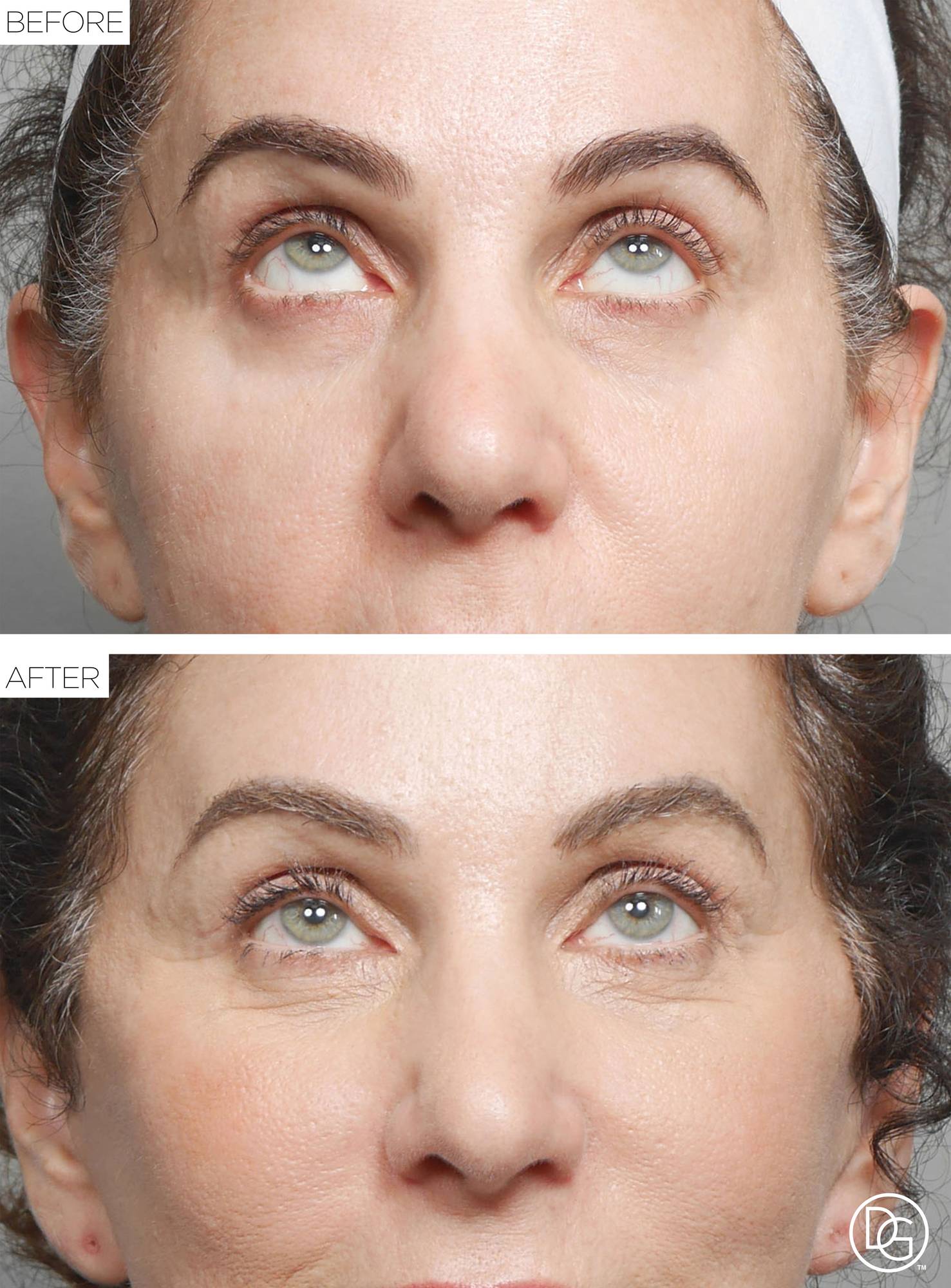 Before & After Image