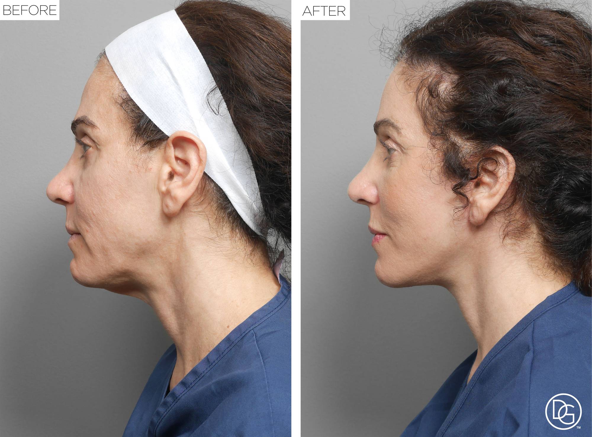 Before & After Image