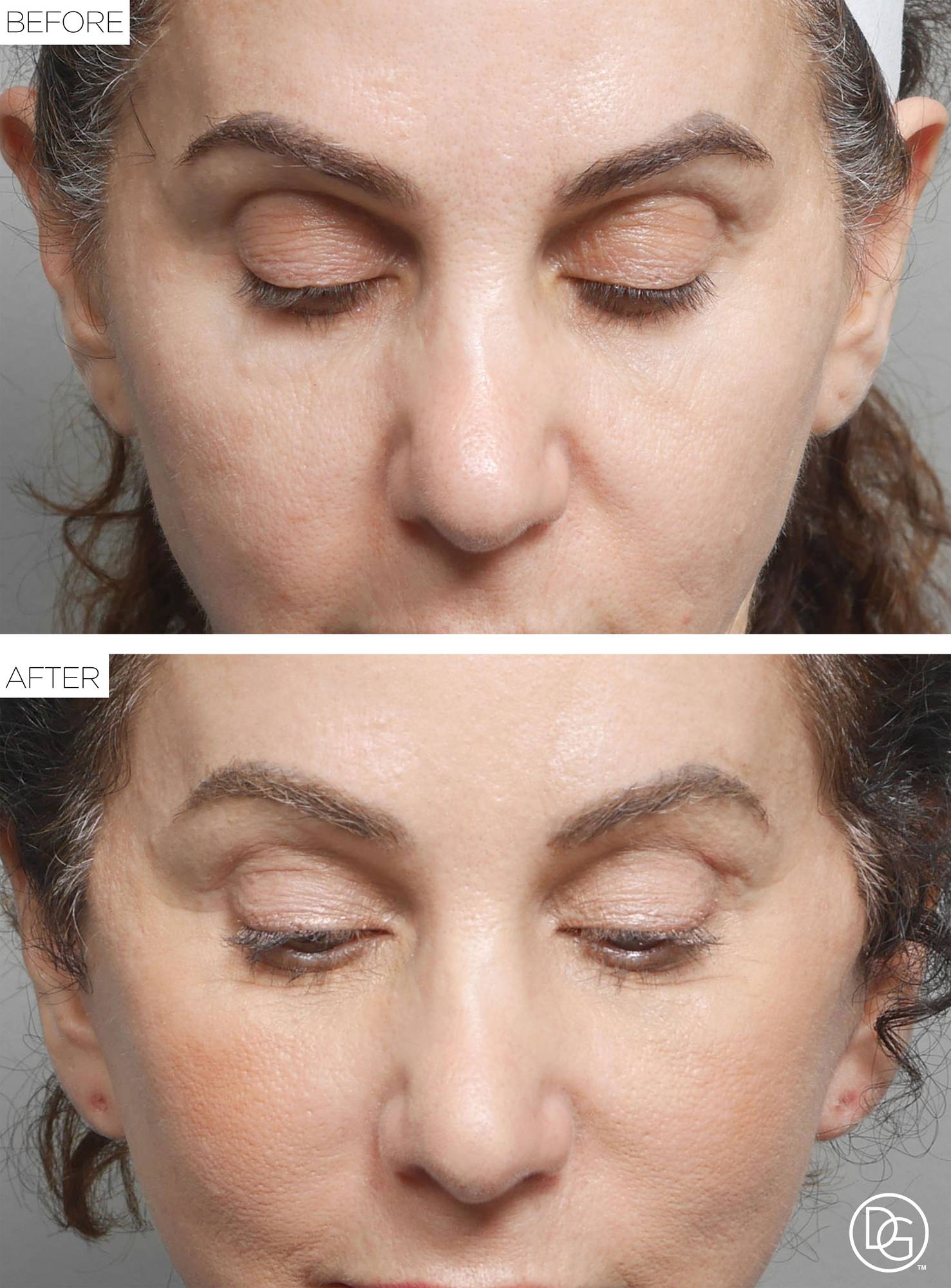 Before & After Image