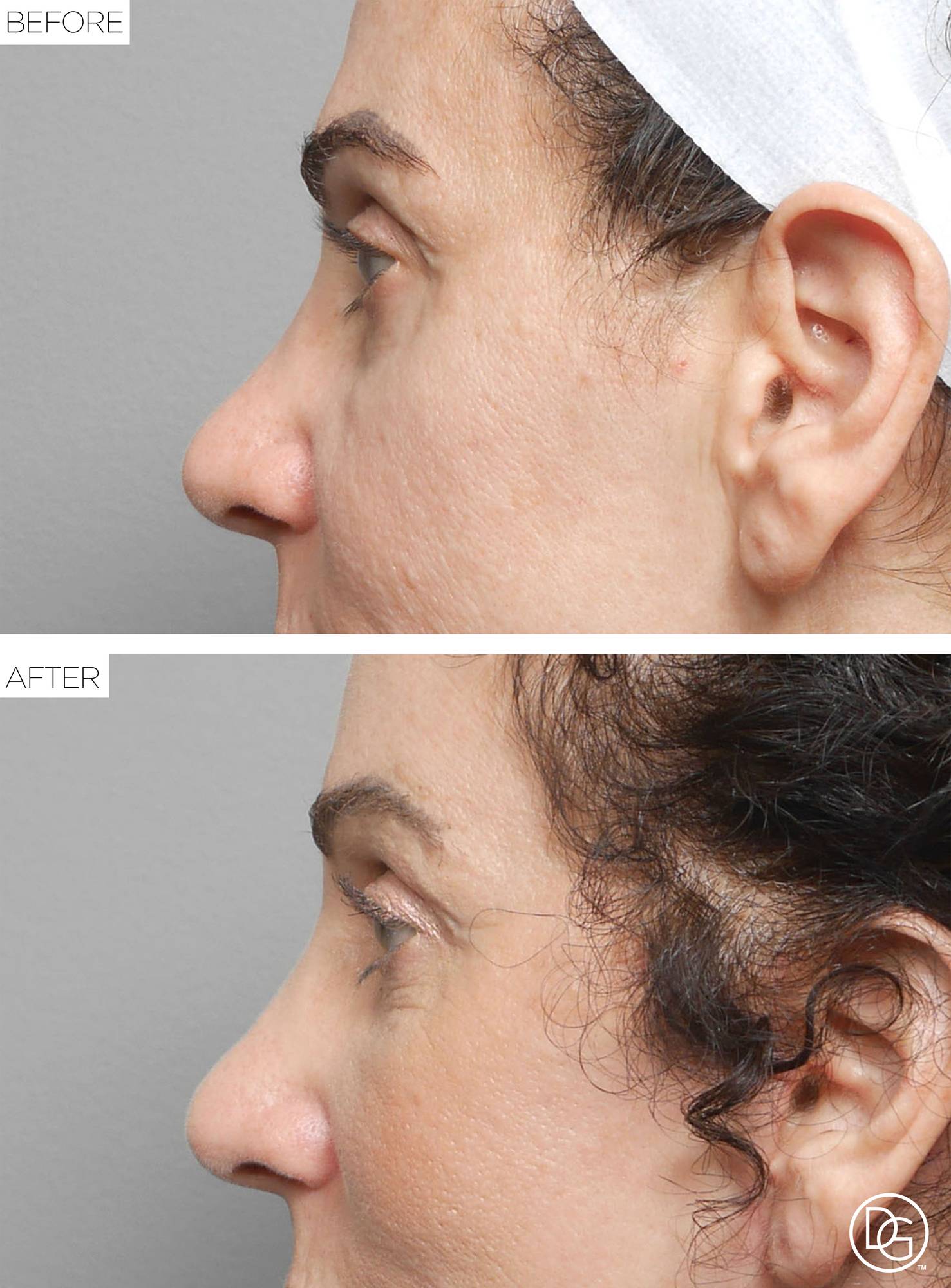 Before & After Image