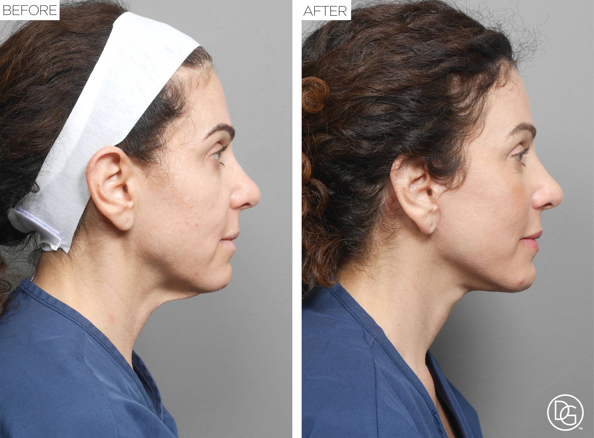 Before & After Image