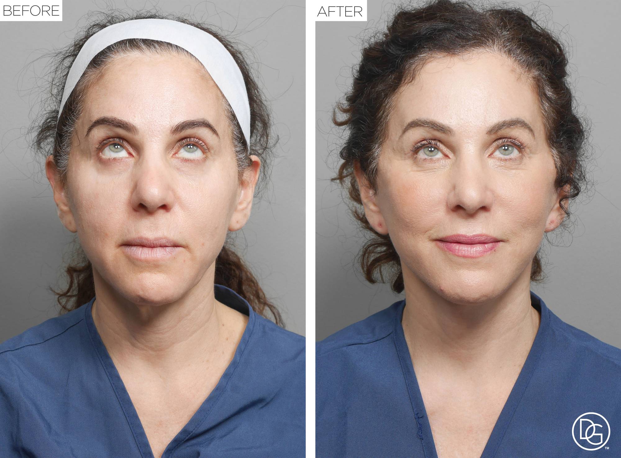 Before & After Image