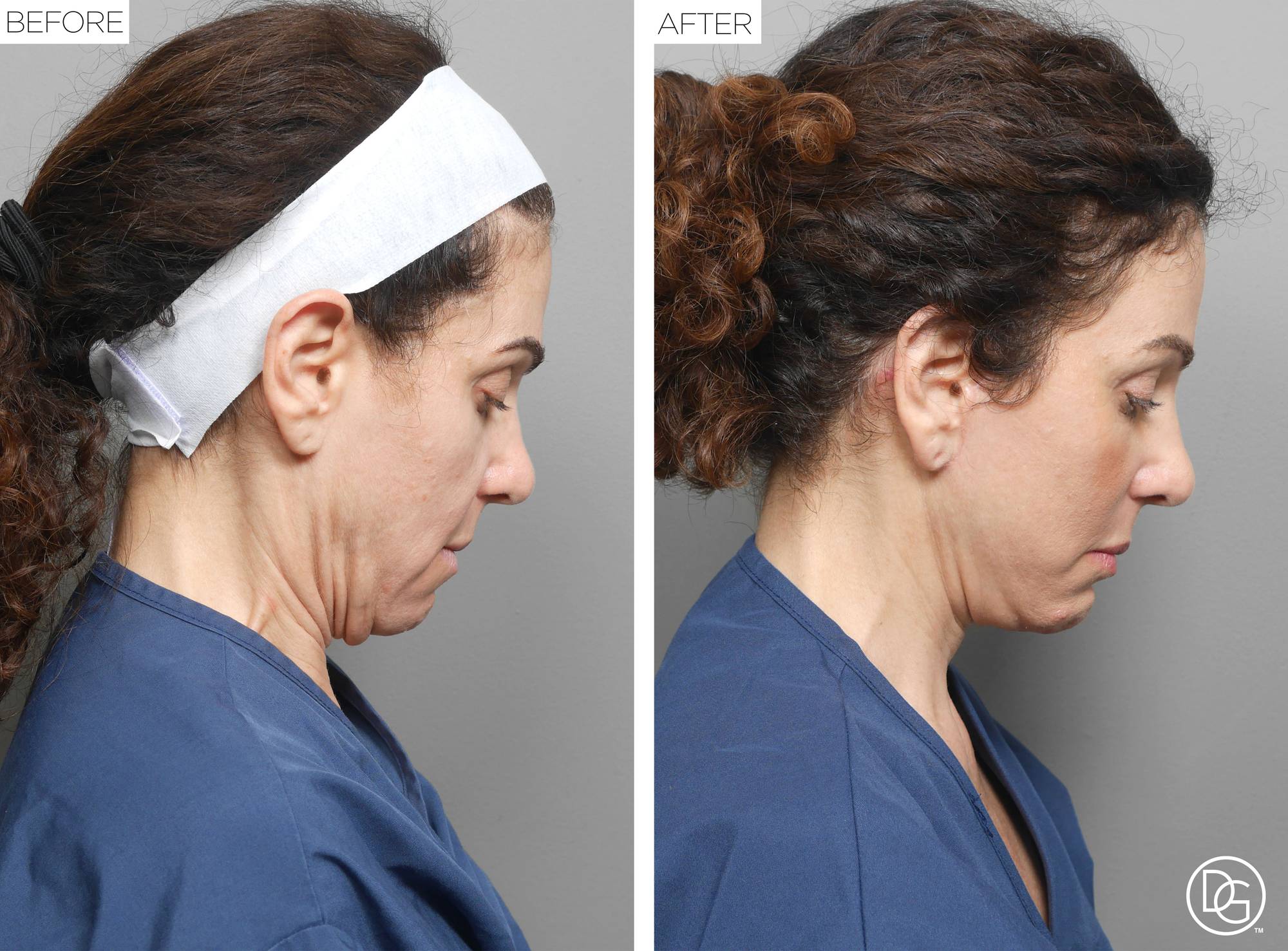 Before & After Image