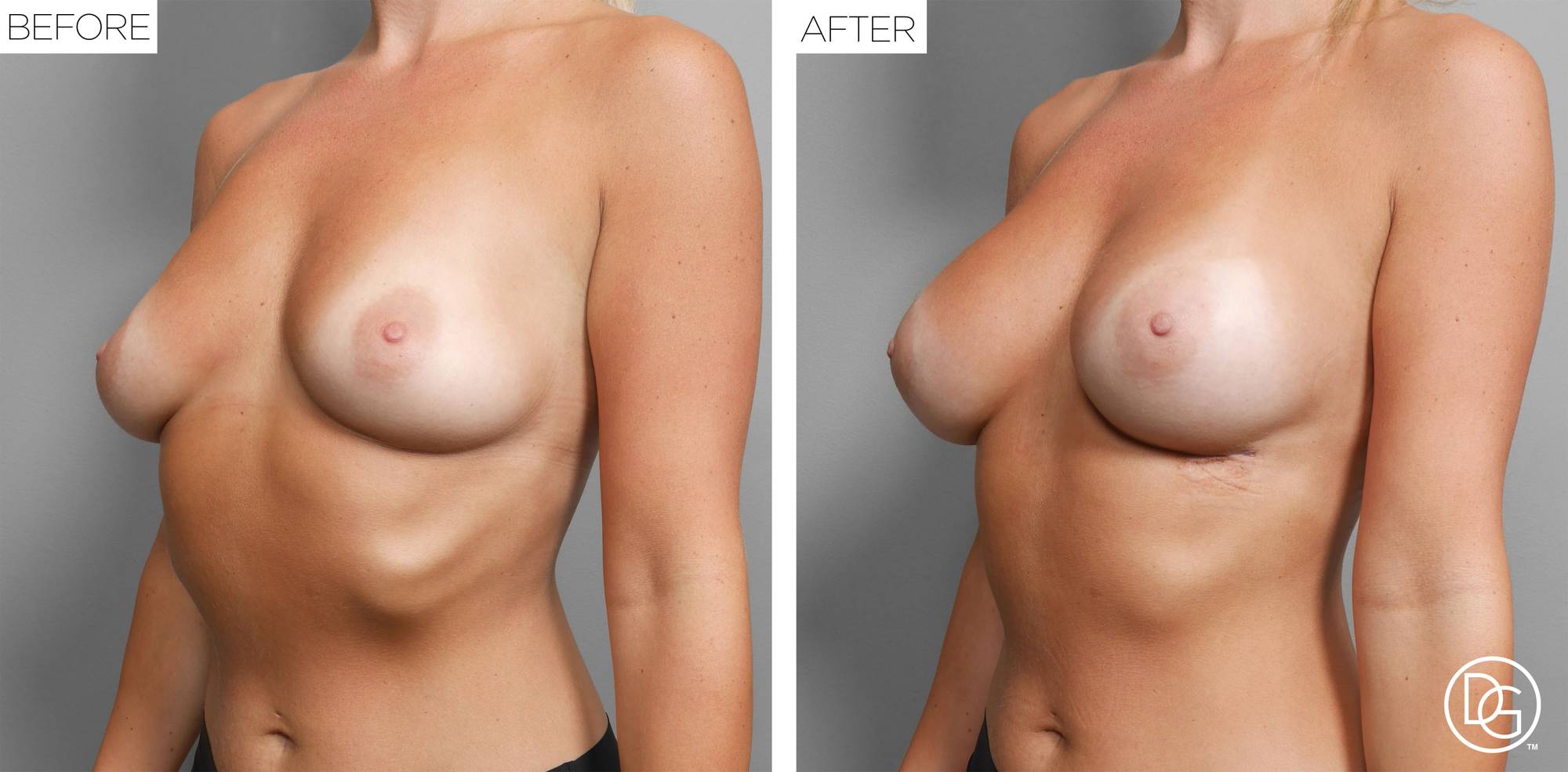 Before & After Image