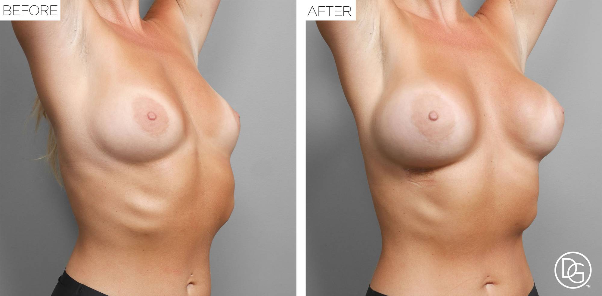 Before & After Image