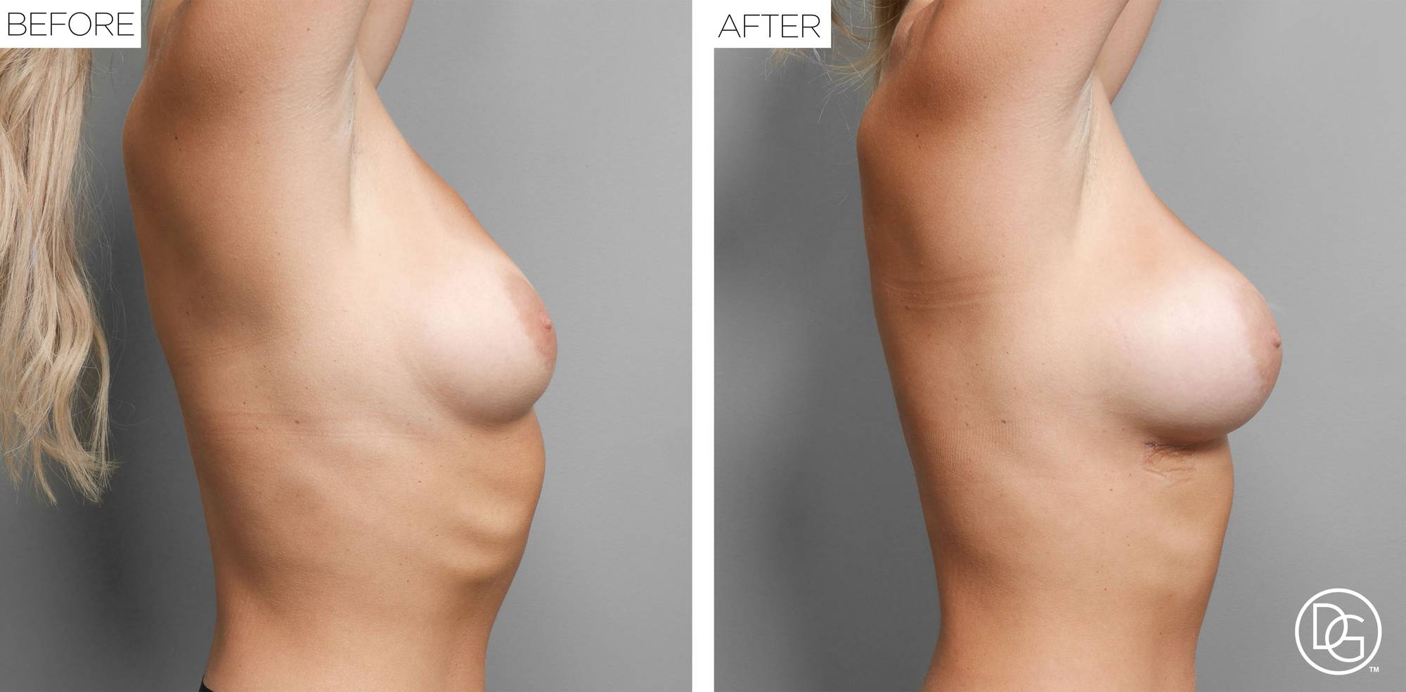 Before & After Image