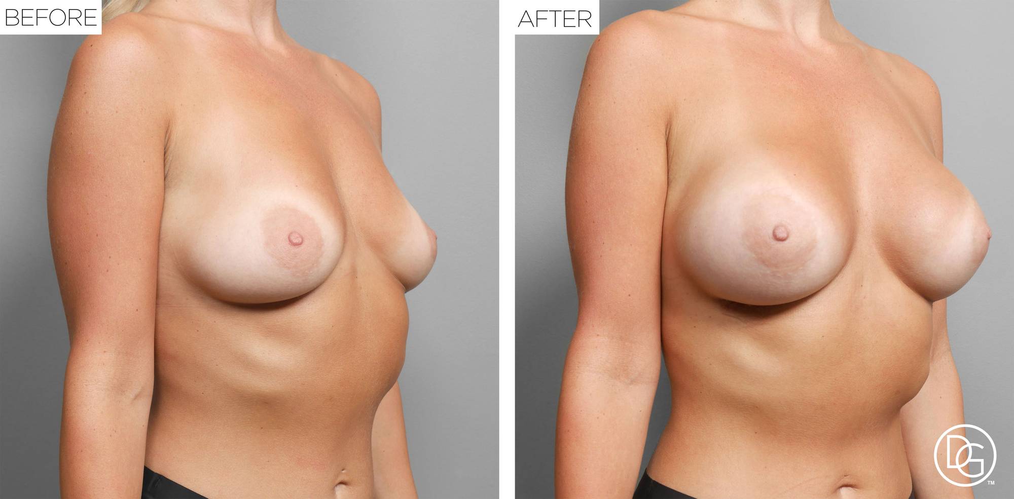 Before & After Image