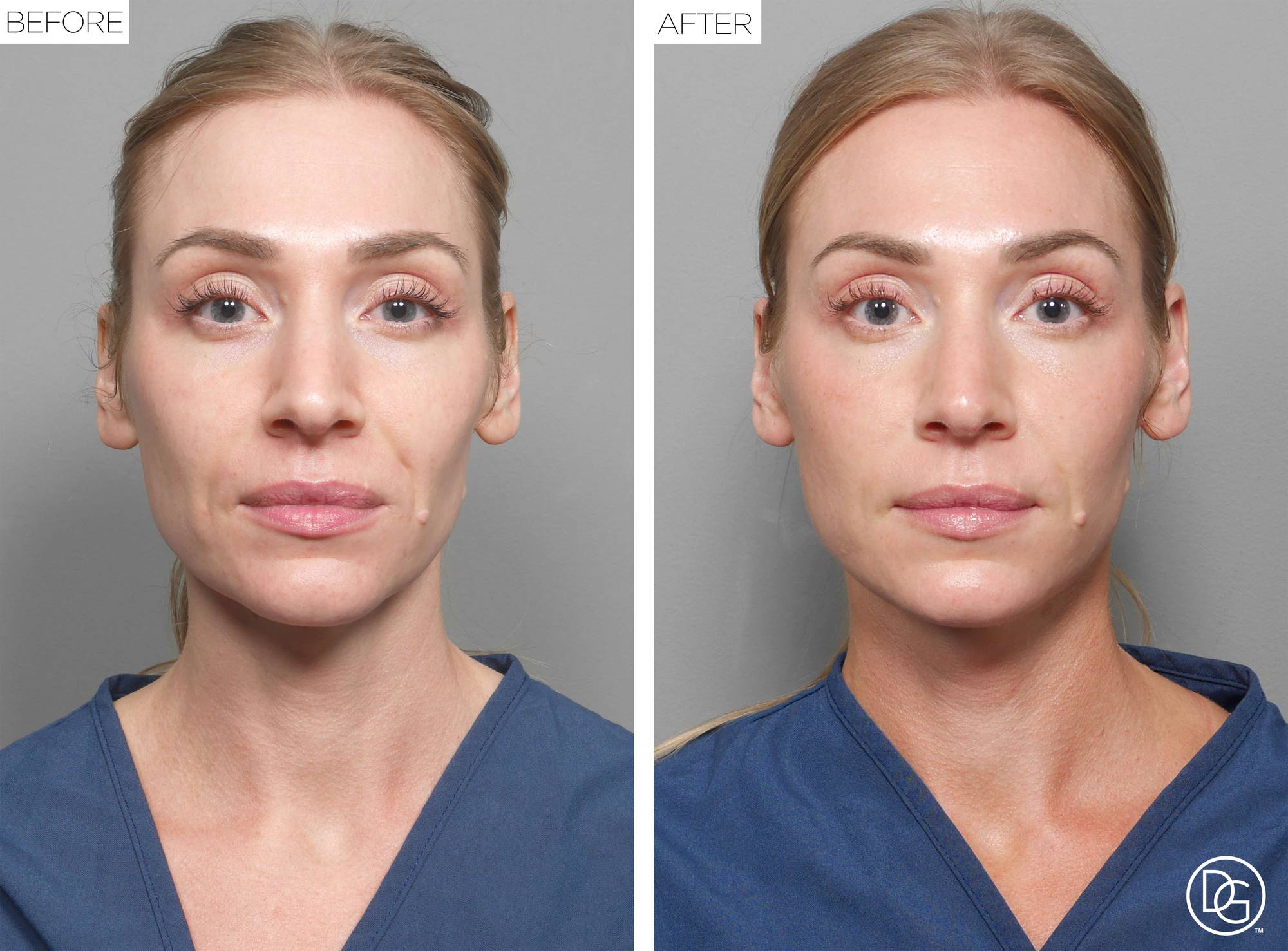 Before & After Image