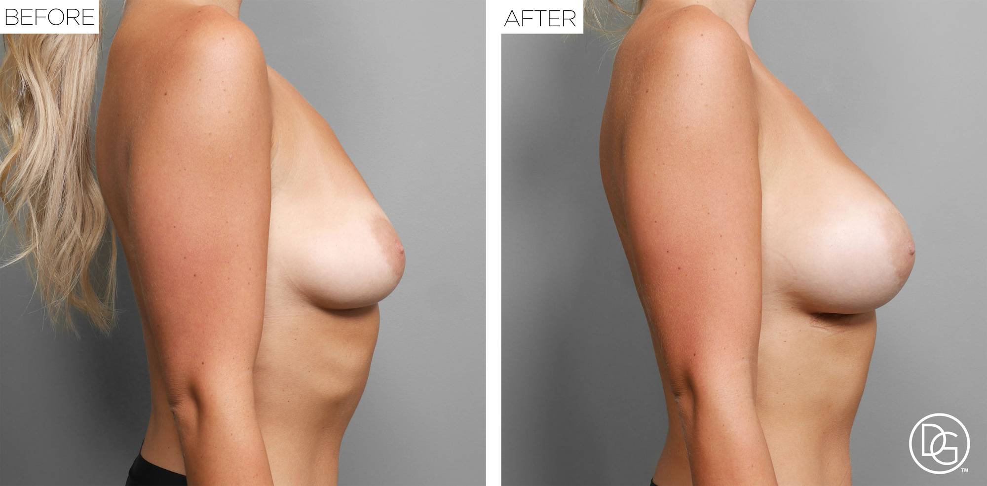 Before & After Image